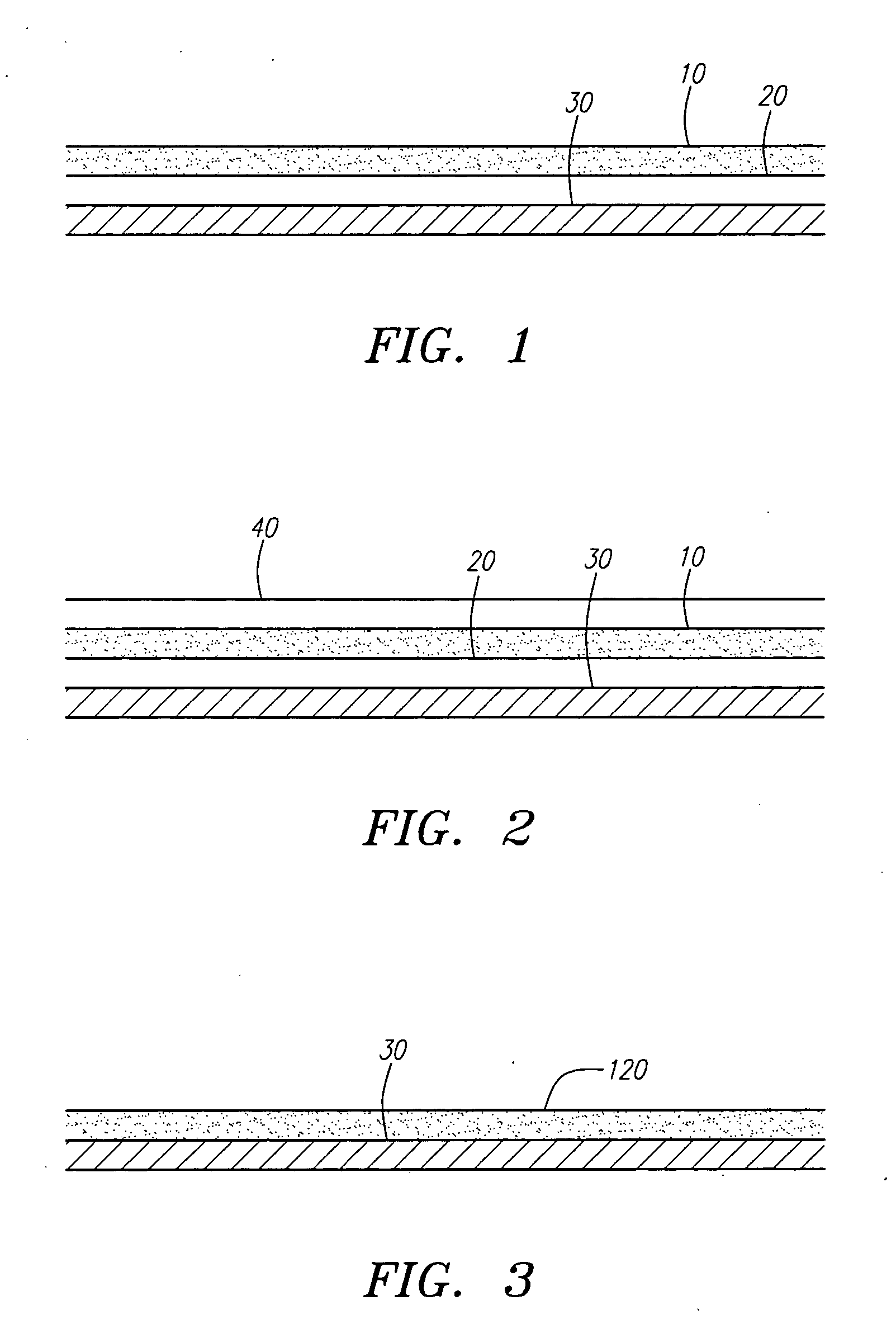 Ultrasound coating for enhancing visualization of medical device in ultrasound images