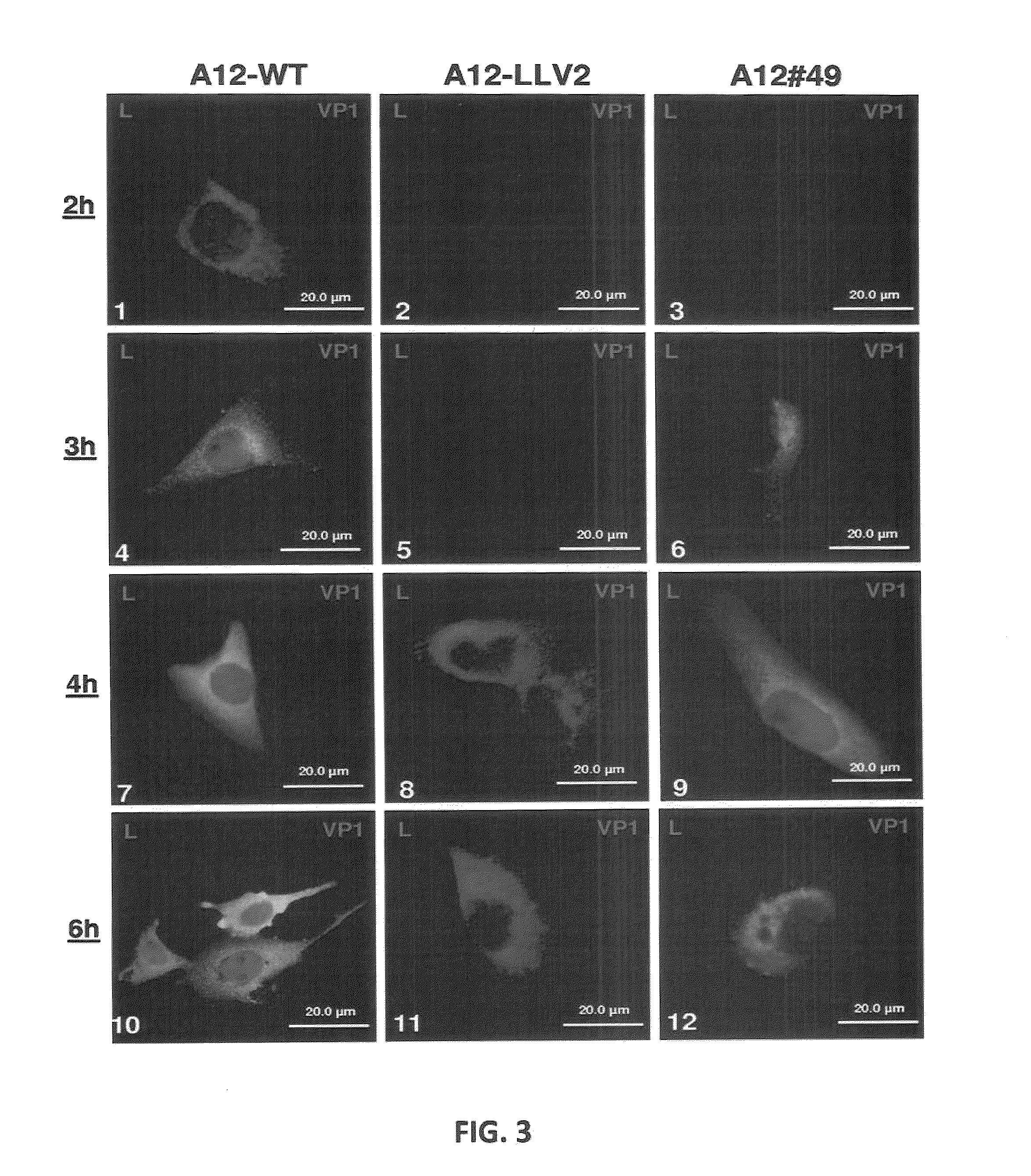 Recombinant live attenuated foot-and-mouth disease (FMD) vaccine containing mutations in the L protein coding region