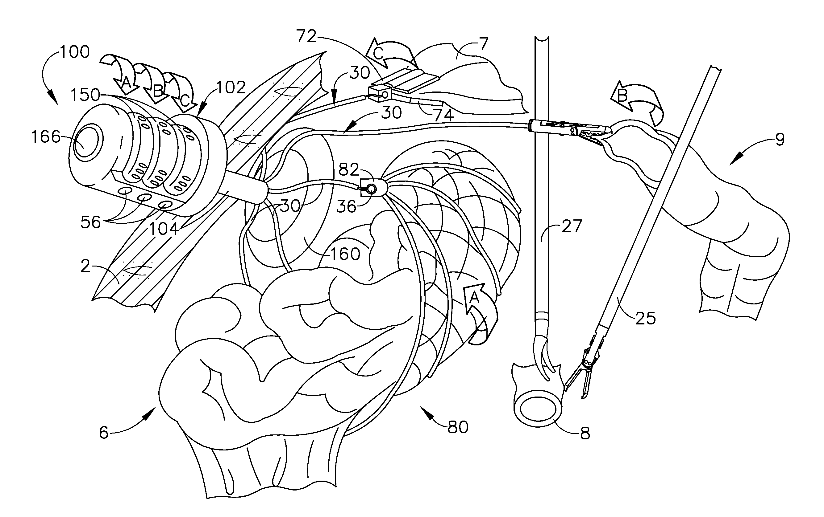 Tissue manipulation devices