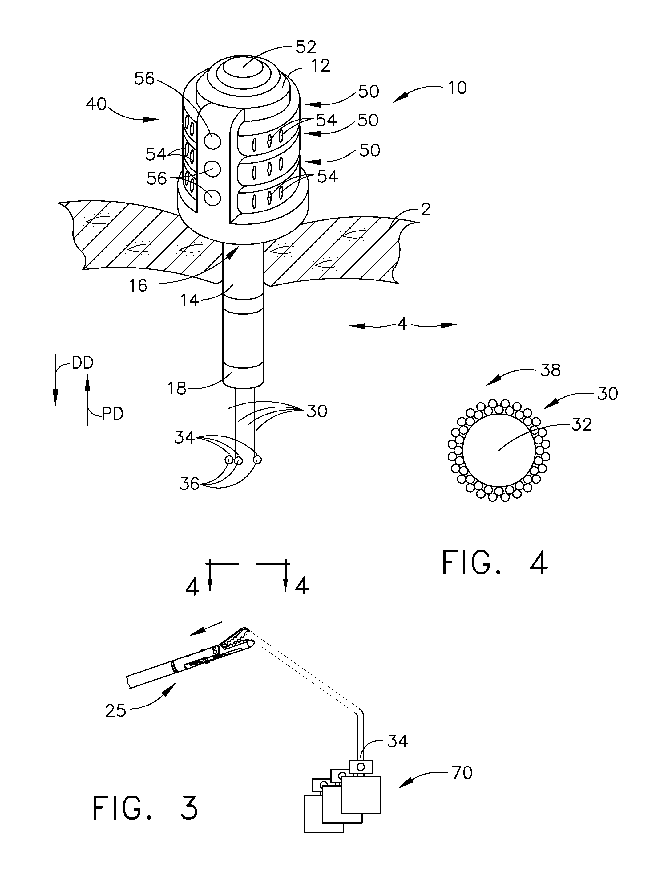 Tissue manipulation devices