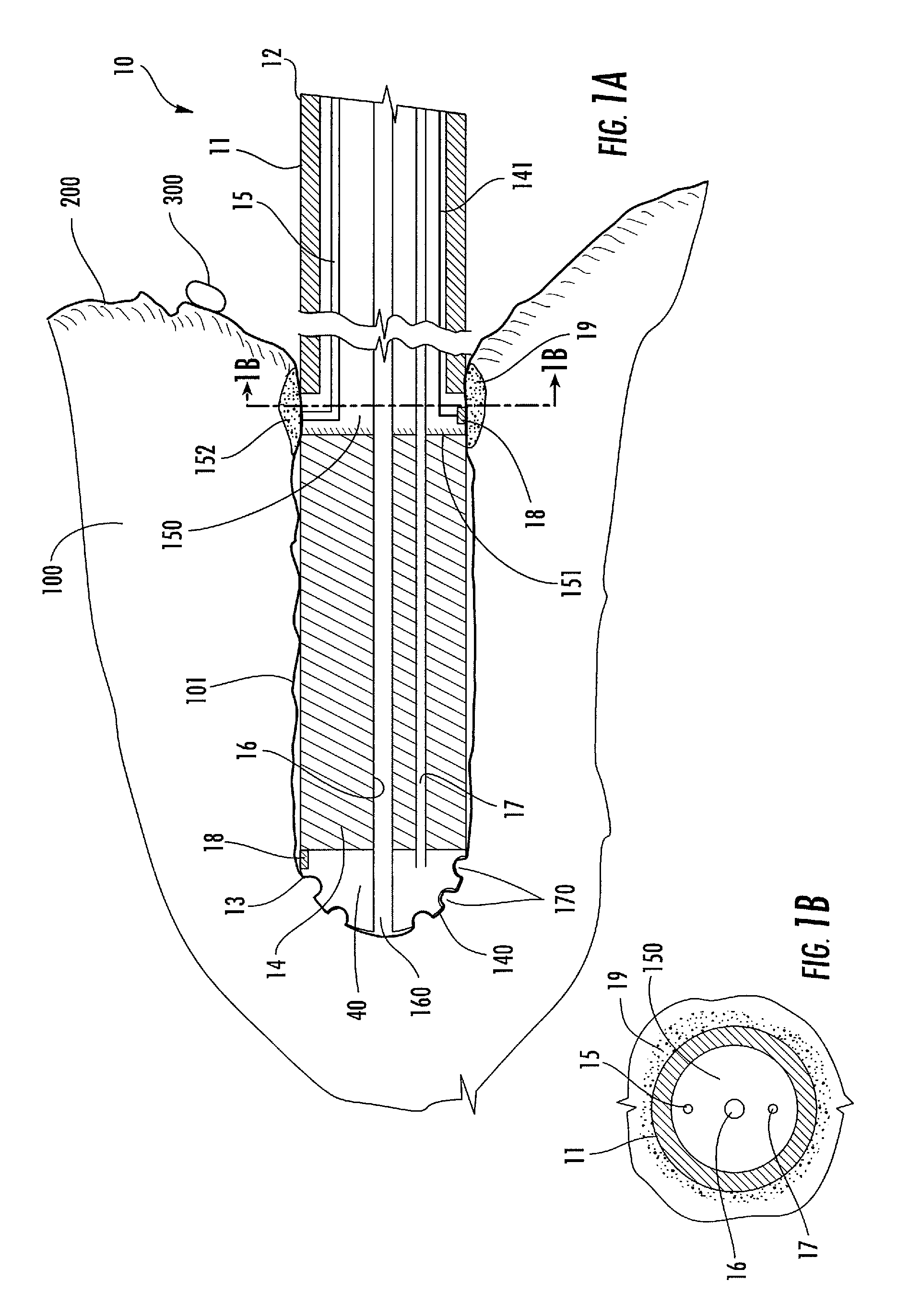 Fluid flowing device and method for tissue diagnosis or therapy