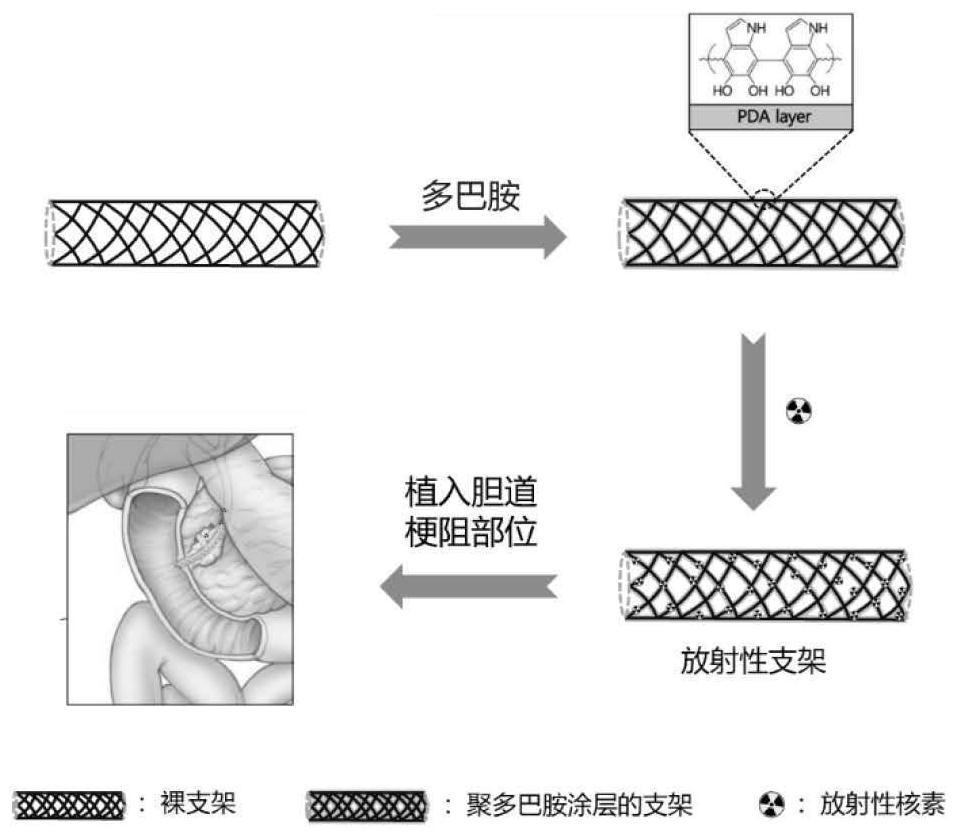 Radioactive lumen stent and preparation method thereof