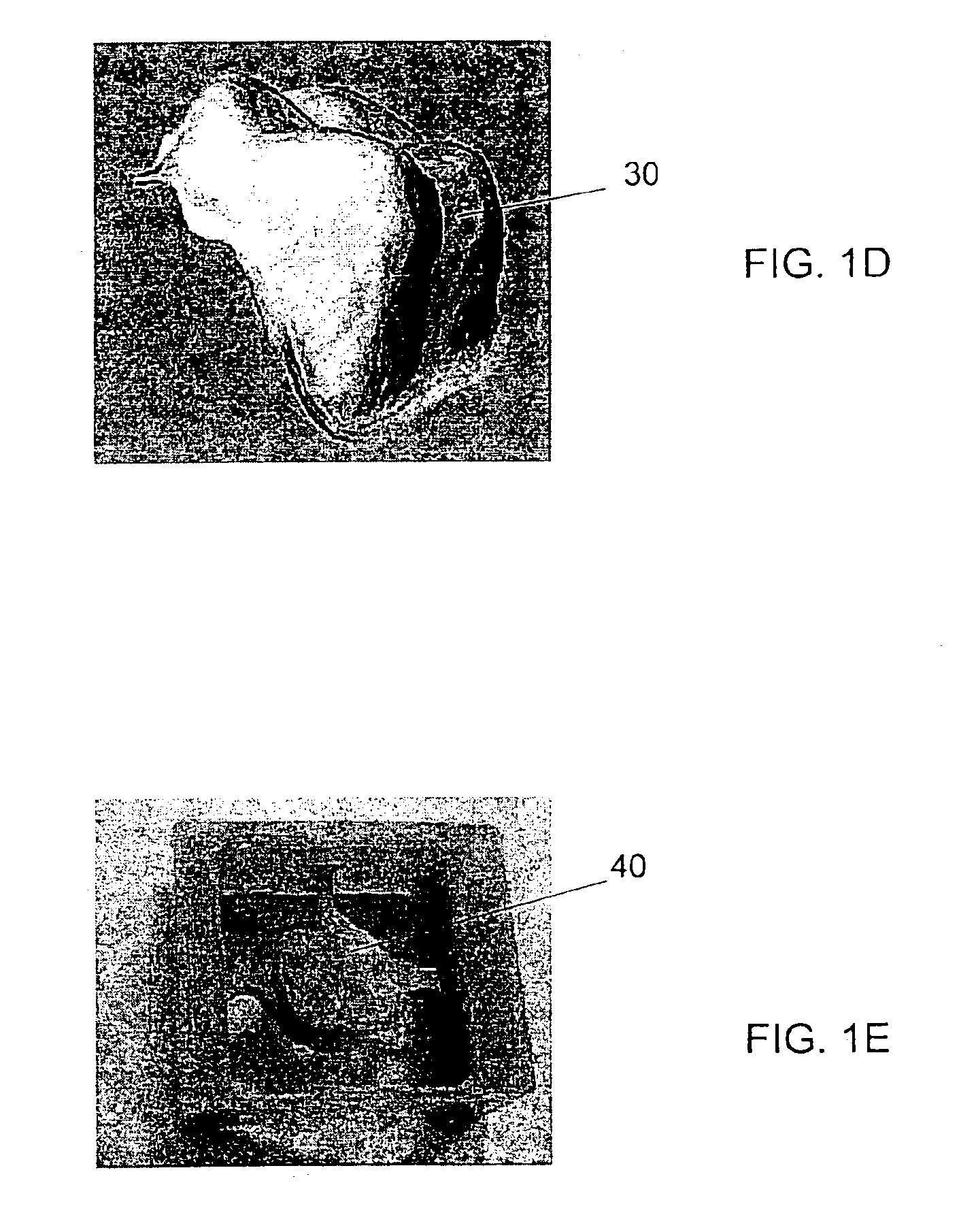 Method and system for fabricating a dental coping, and a coping fabricated thereby