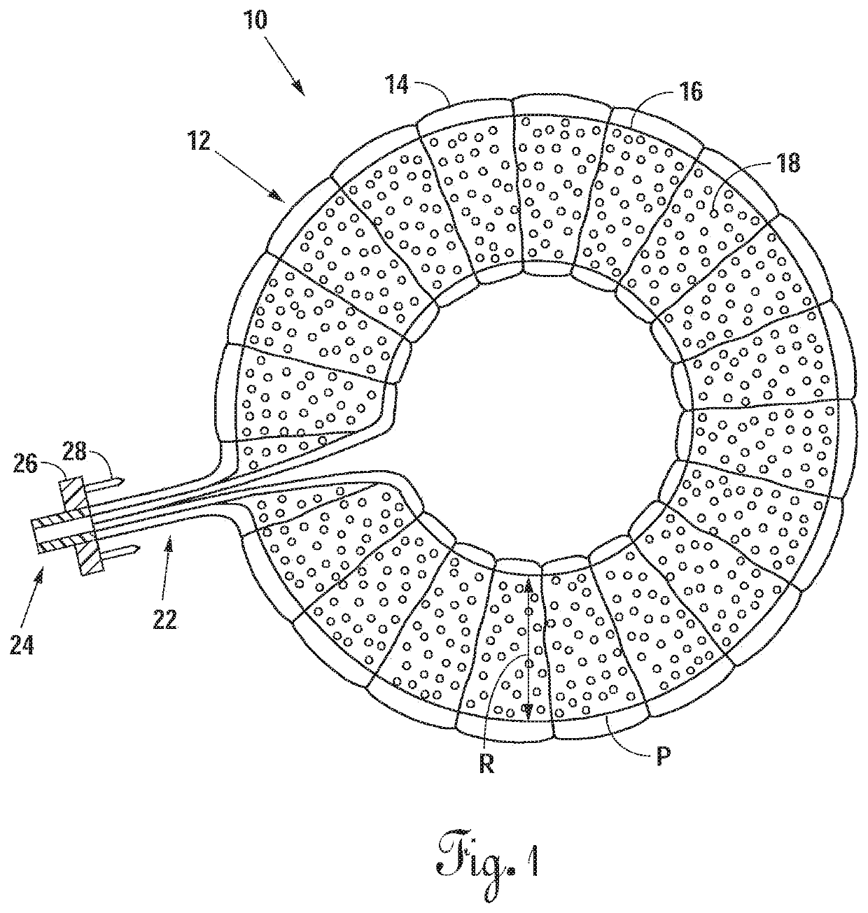 Radially expandable annulus reinforcement prosthesis