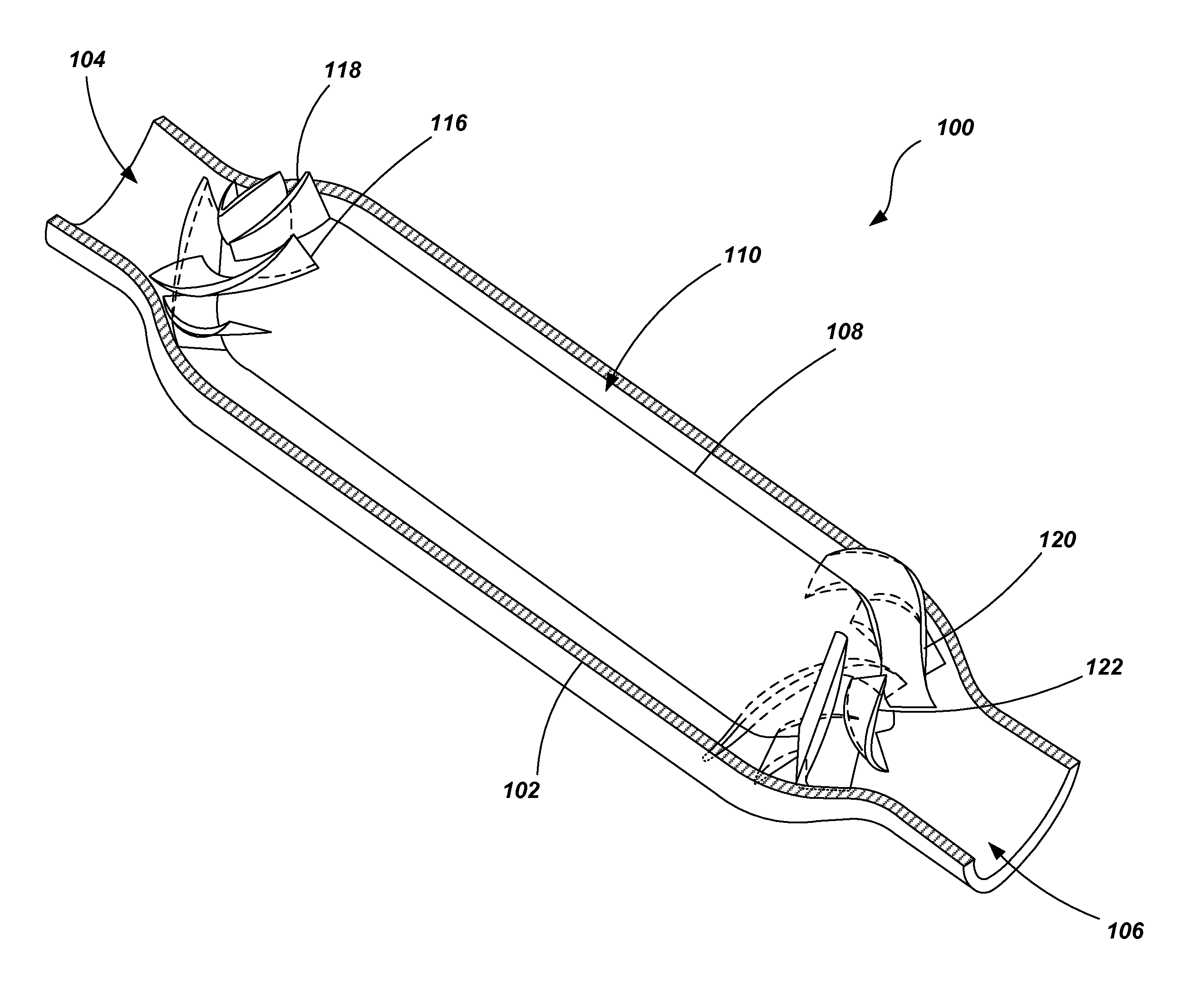 Blood pump with splitter impeller blades and splitter stator vanes and related methods