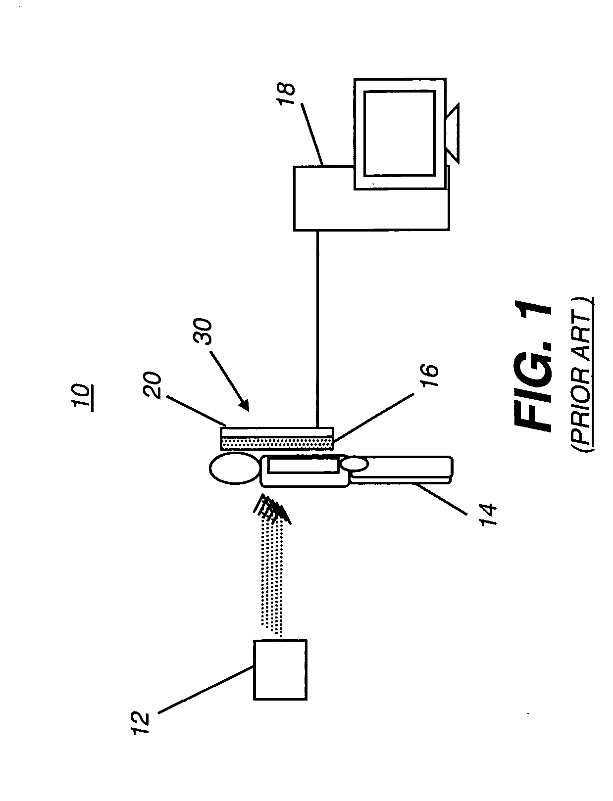 Long length imaging using digital radiography