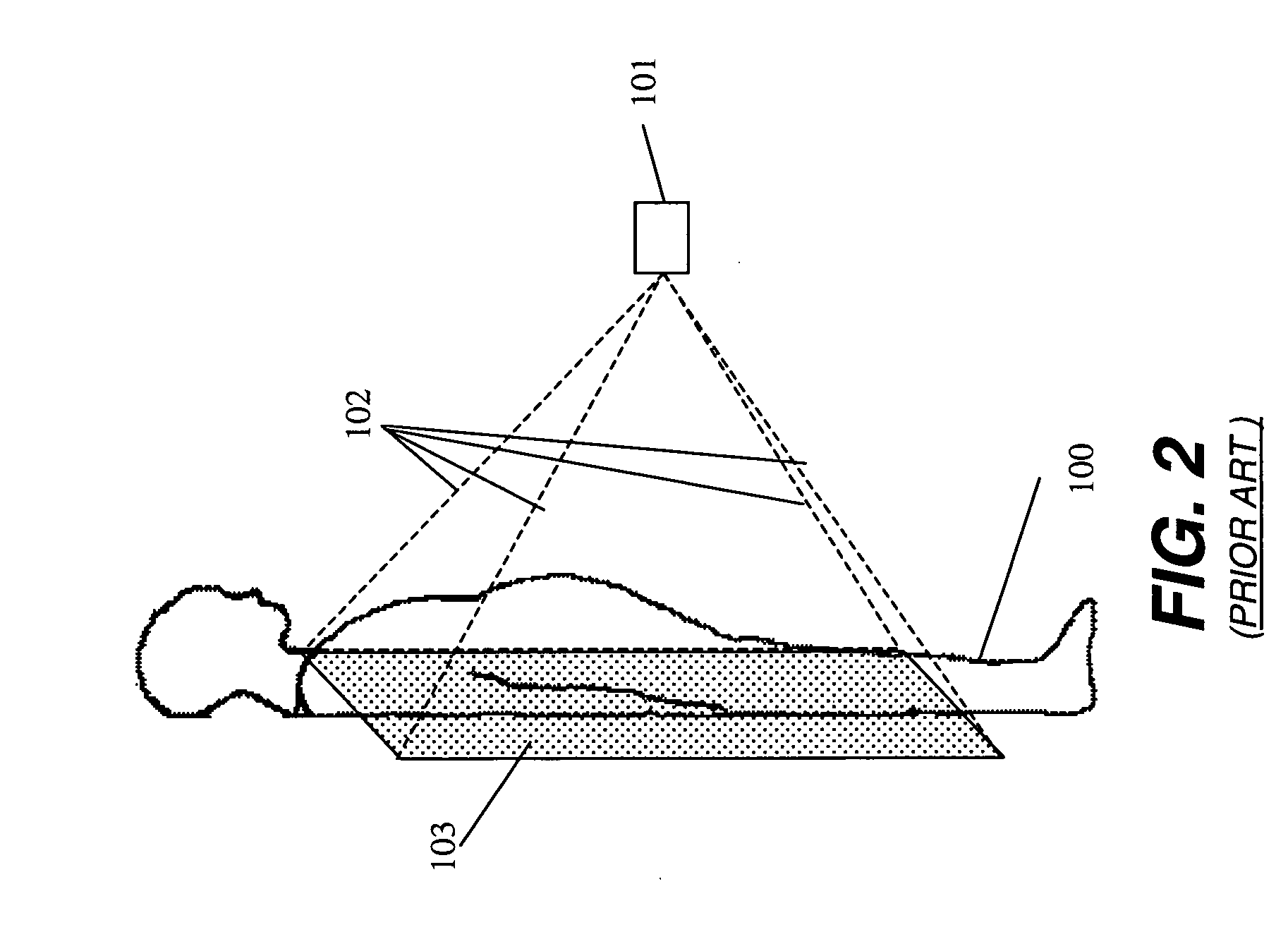 Long length imaging using digital radiography