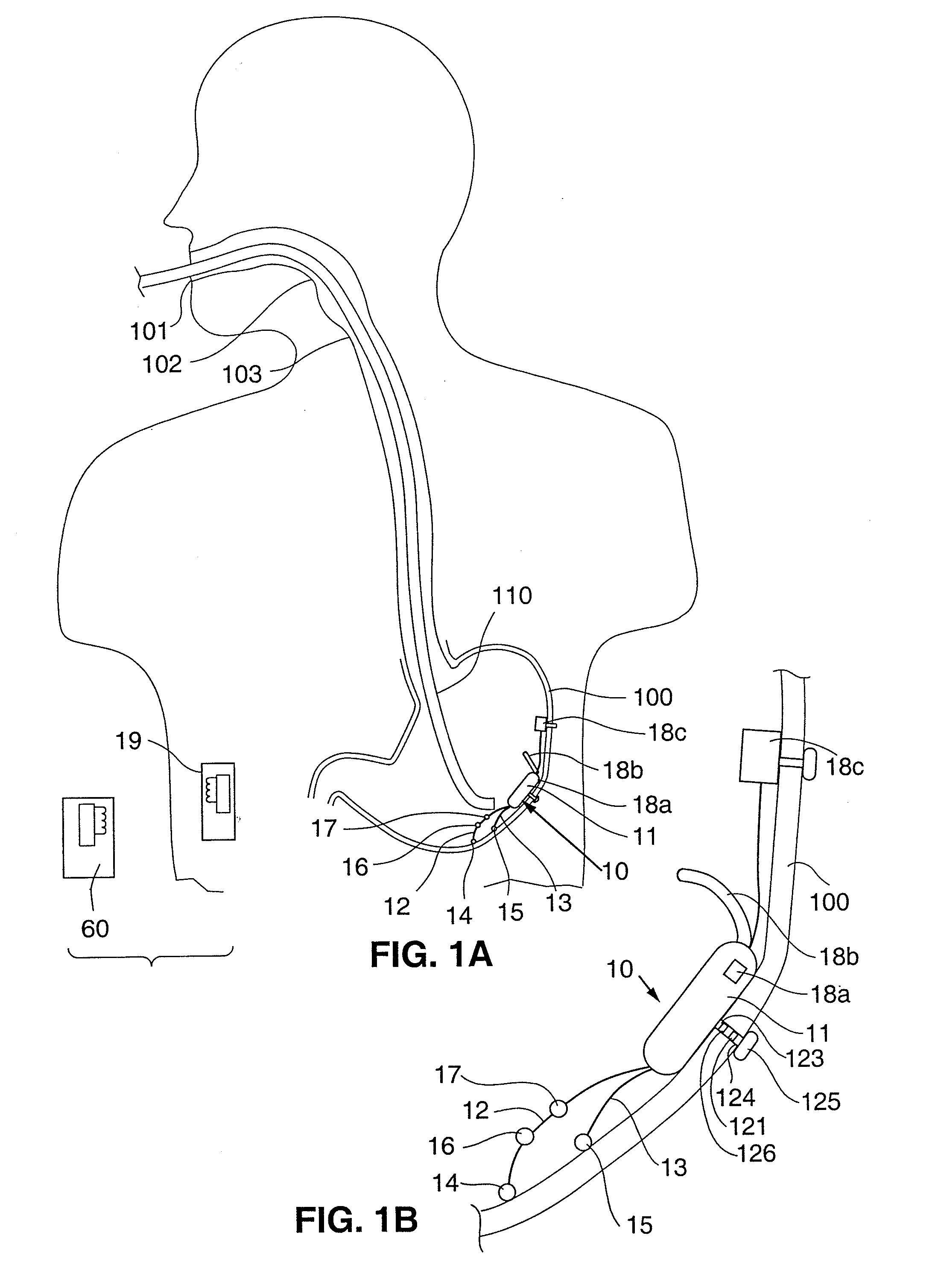 Responsive gastric stimulator