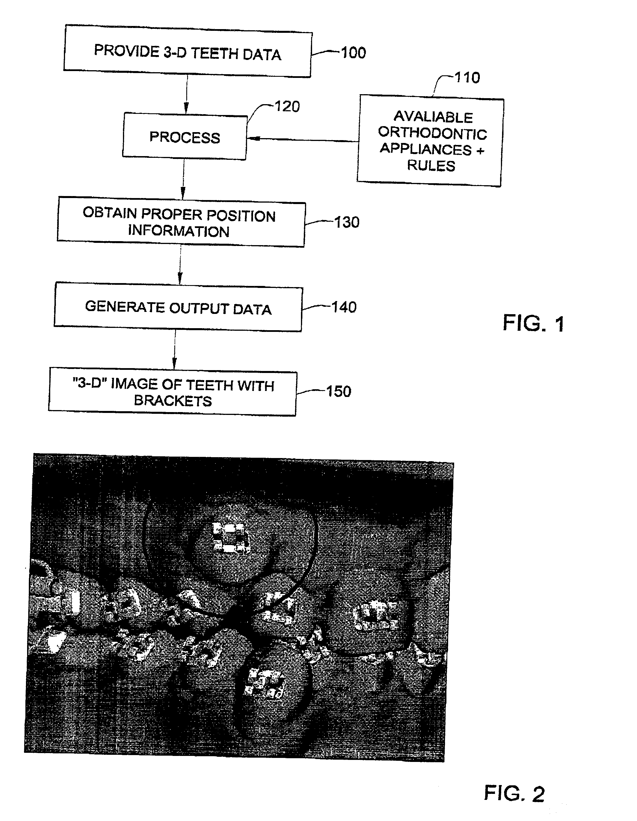 Method and system for assisting in applying an orthodontic treatment