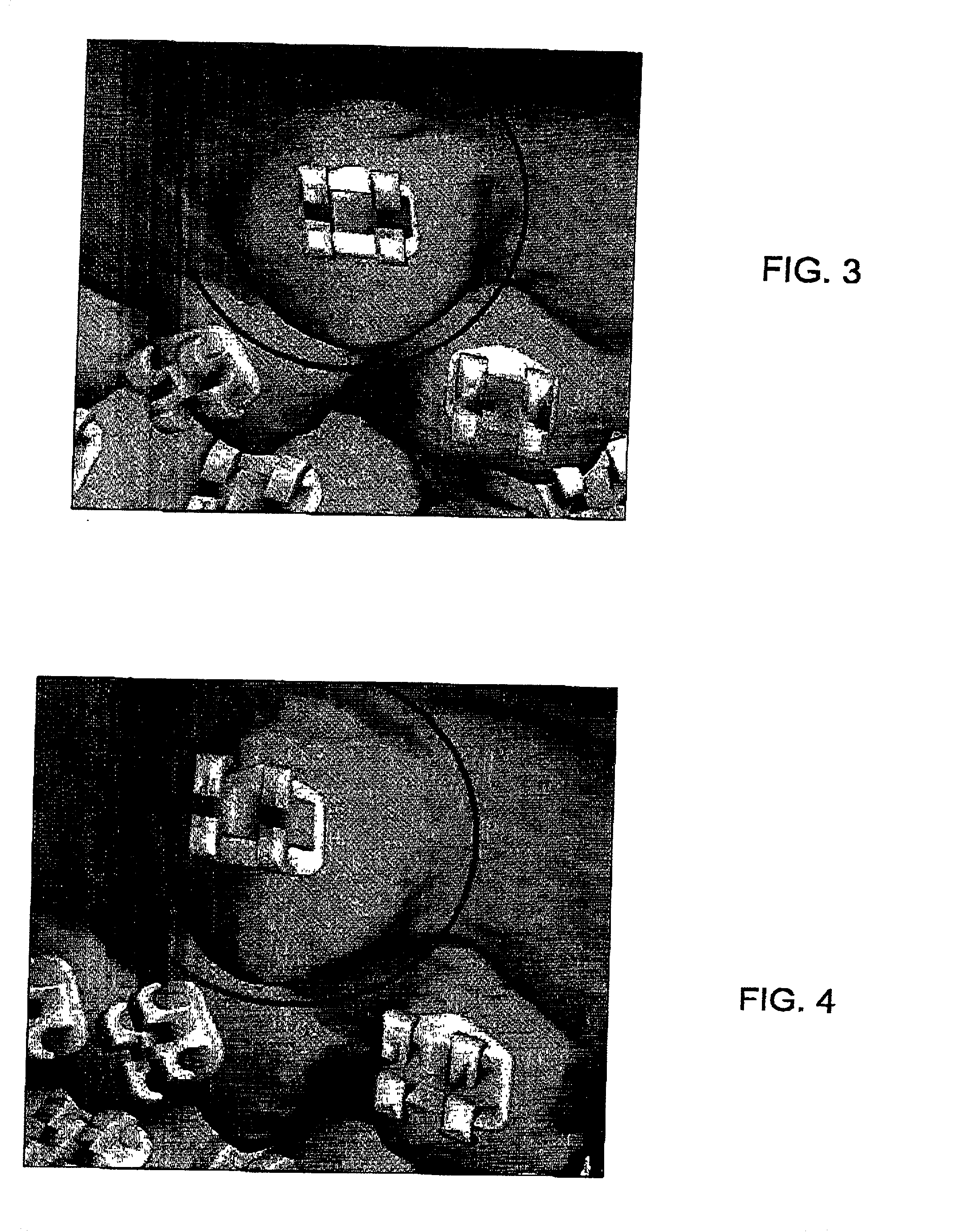 Method and system for assisting in applying an orthodontic treatment