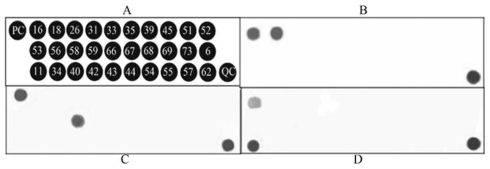 A kind of hpv gene chip and its preparation method and application