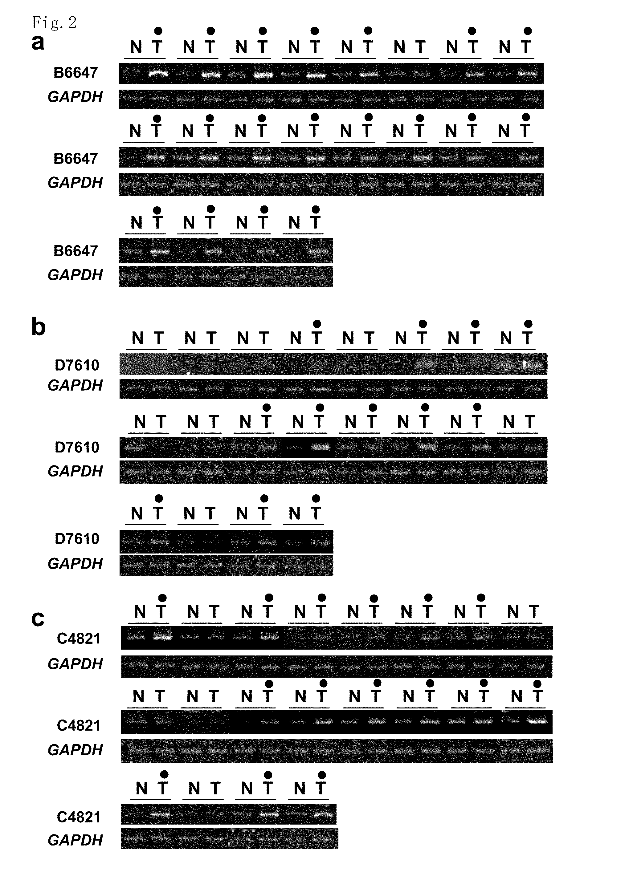 Method of diagnosing colon and gastric cancers