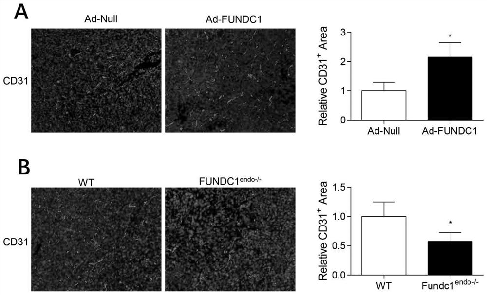 Application of FUNDC1 in preparation of medicine for preventing and treating vascular and tumor diseases