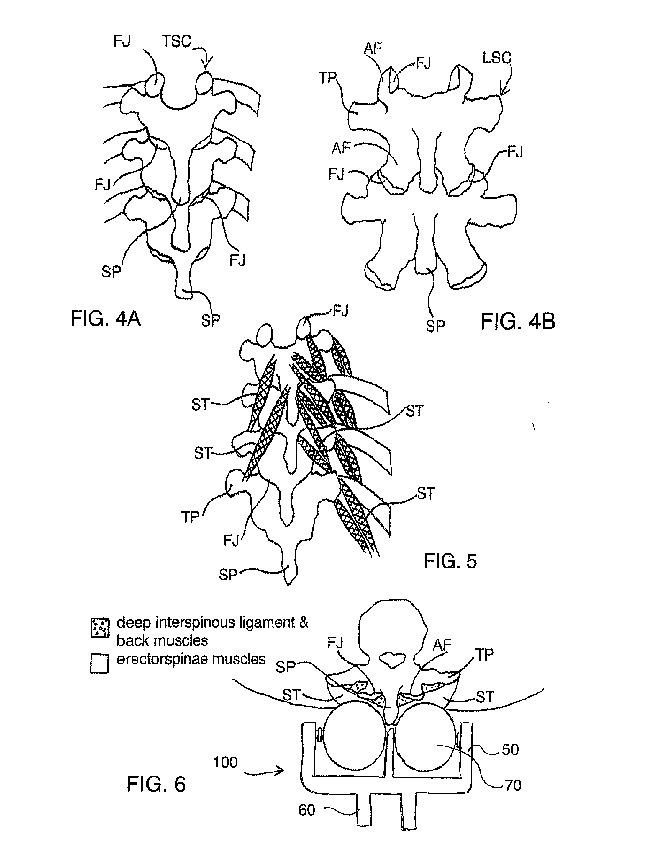 Massage Apparatus with Spherical Elements