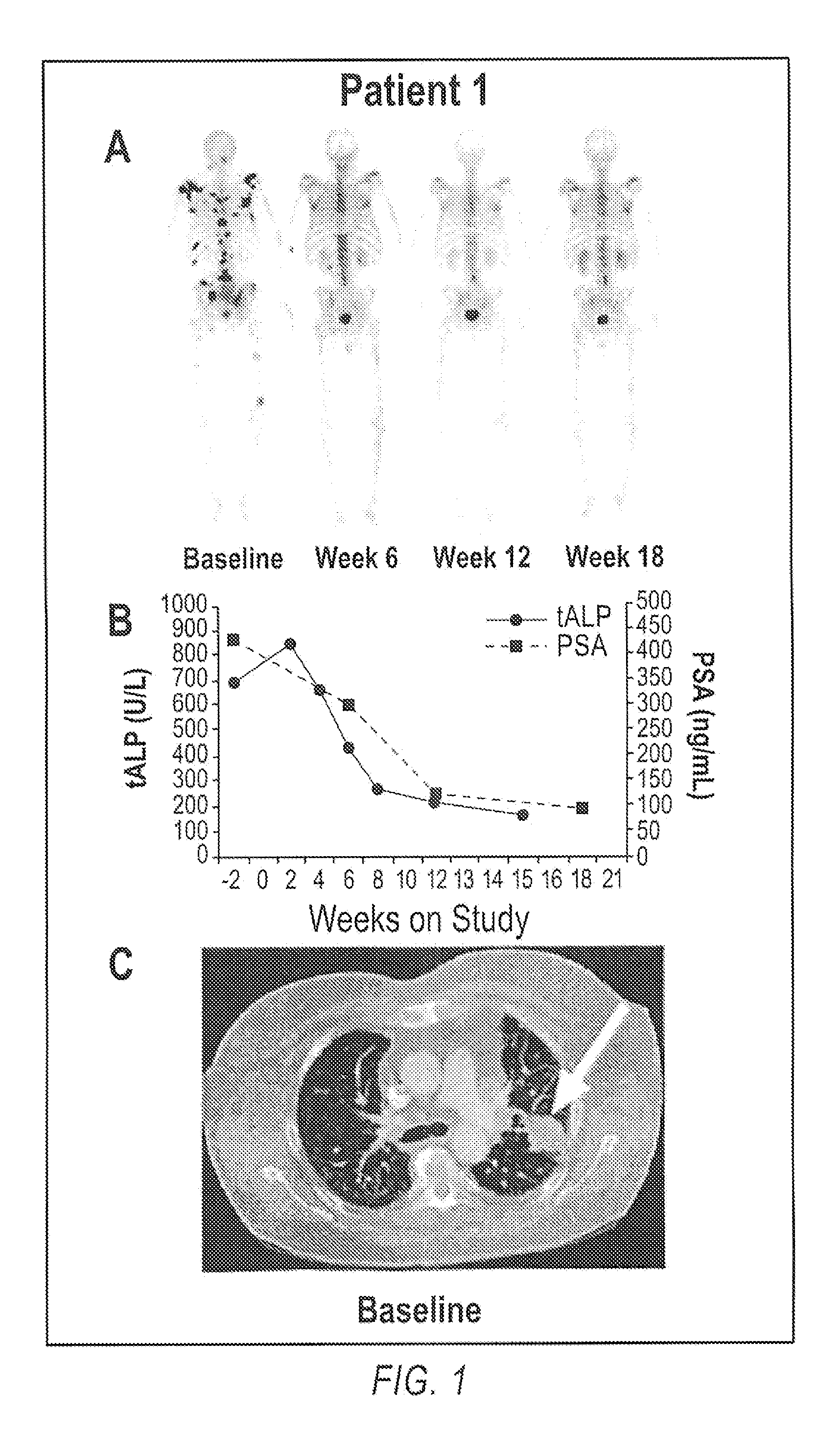 Method of Treating Cancer