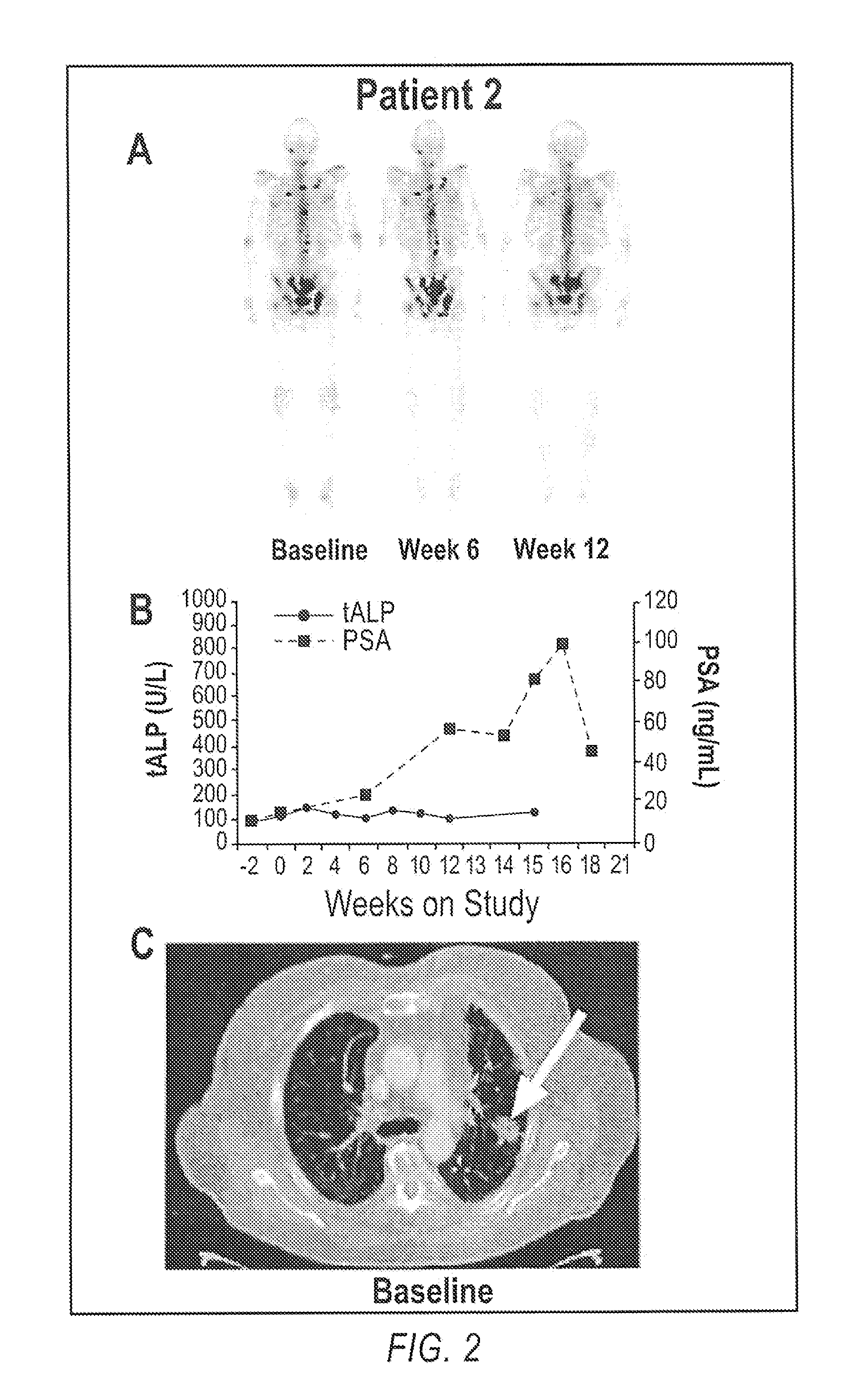 Method of Treating Cancer