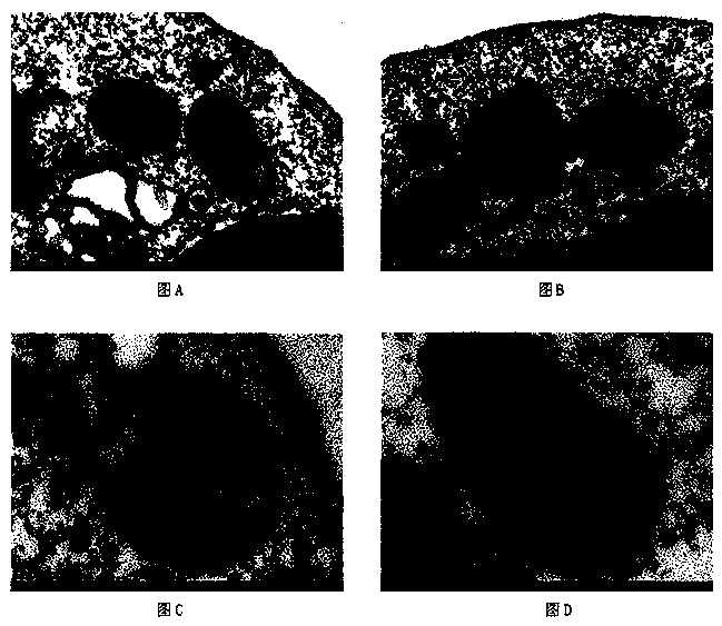 Application of ATPIF1 gene silenced T cells in preparation of antitumor drugs