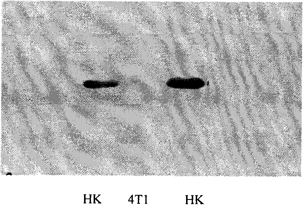 Preparation of ELISA kit of human tissue kallikrein