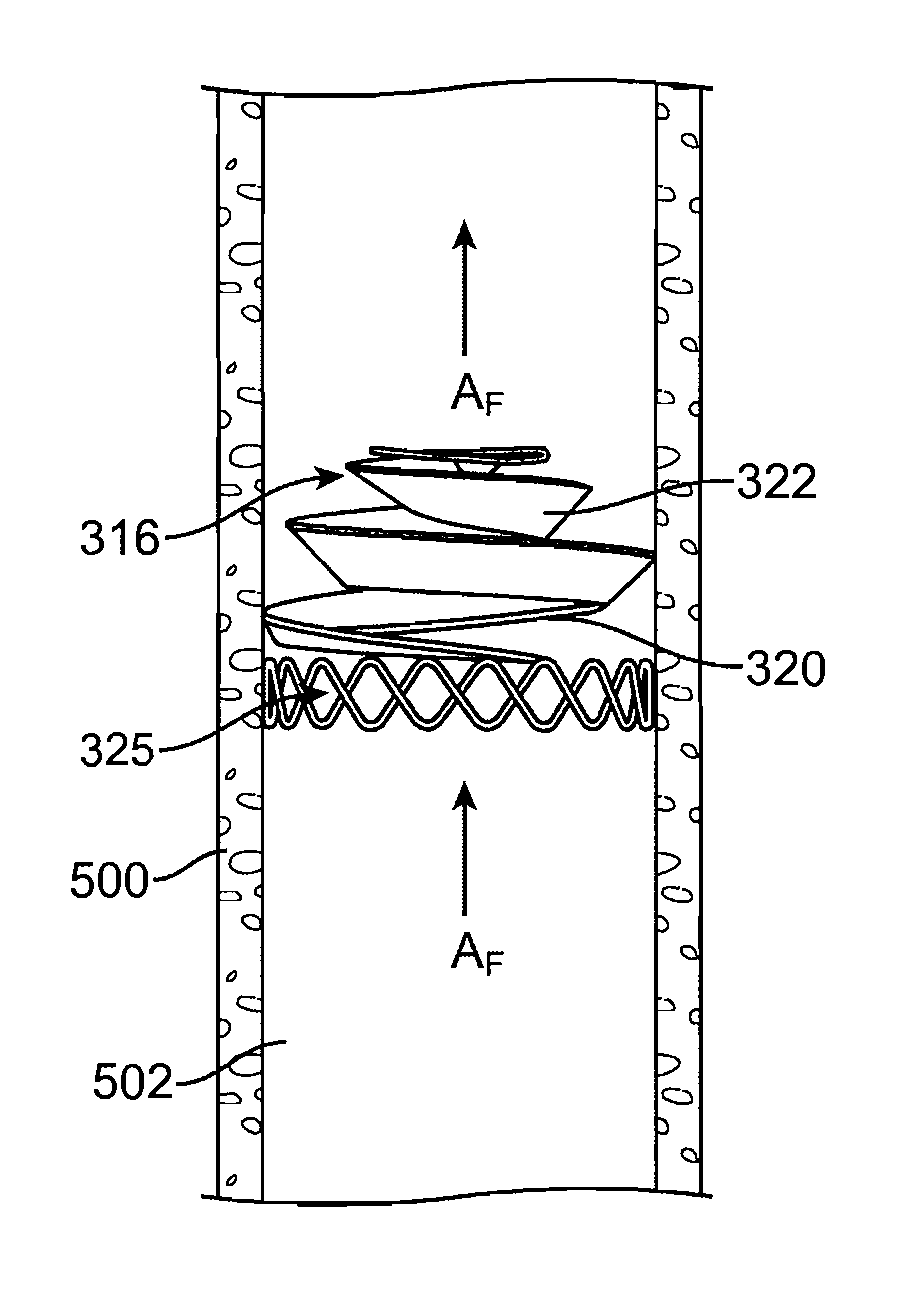 Implantable valve prosthesis for treating venous valve insufficiency