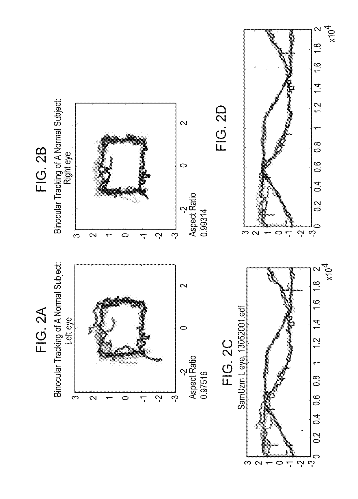 Methods and kits for assessing neurological function and localizing neurological lesions