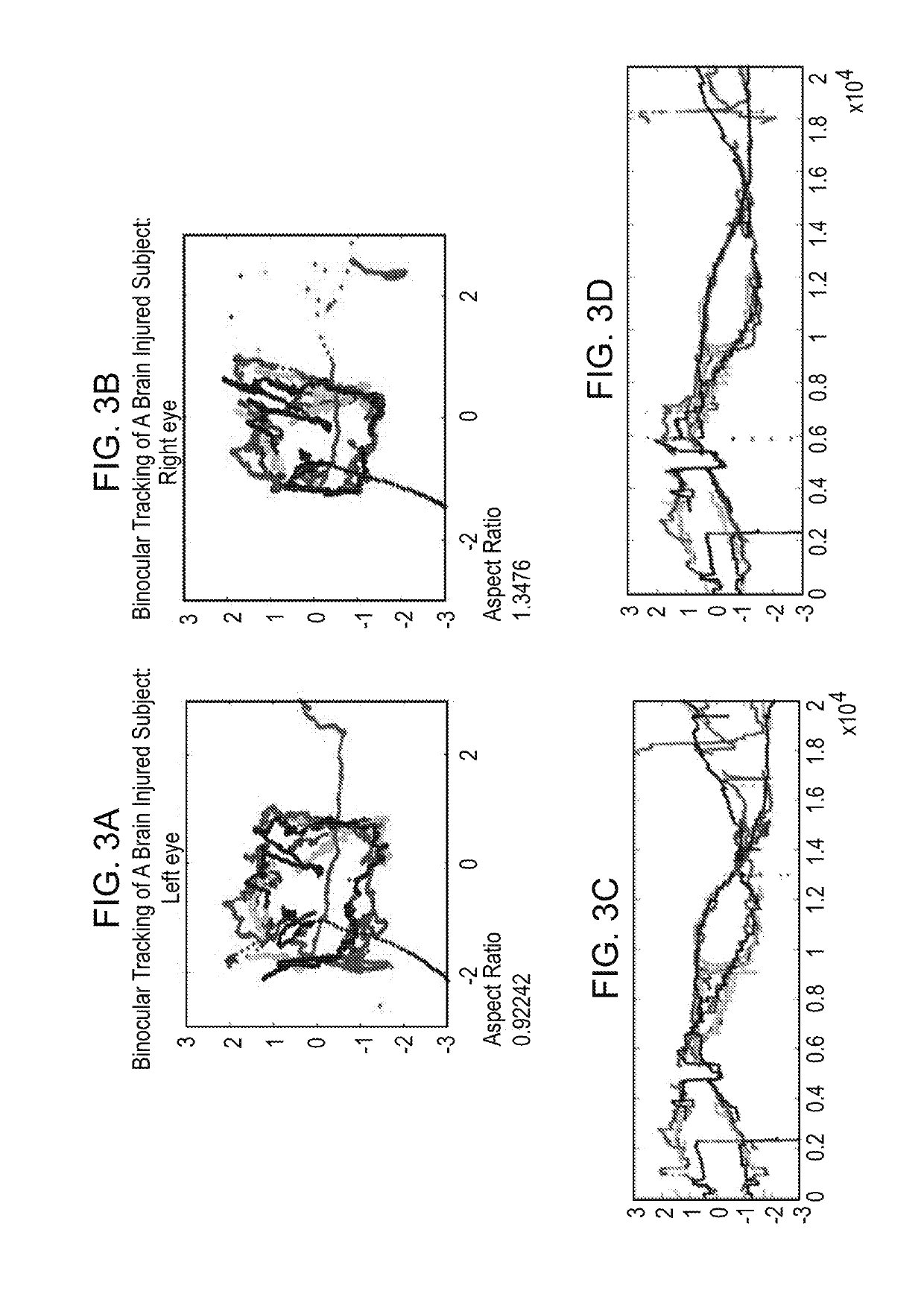 Methods and kits for assessing neurological function and localizing neurological lesions