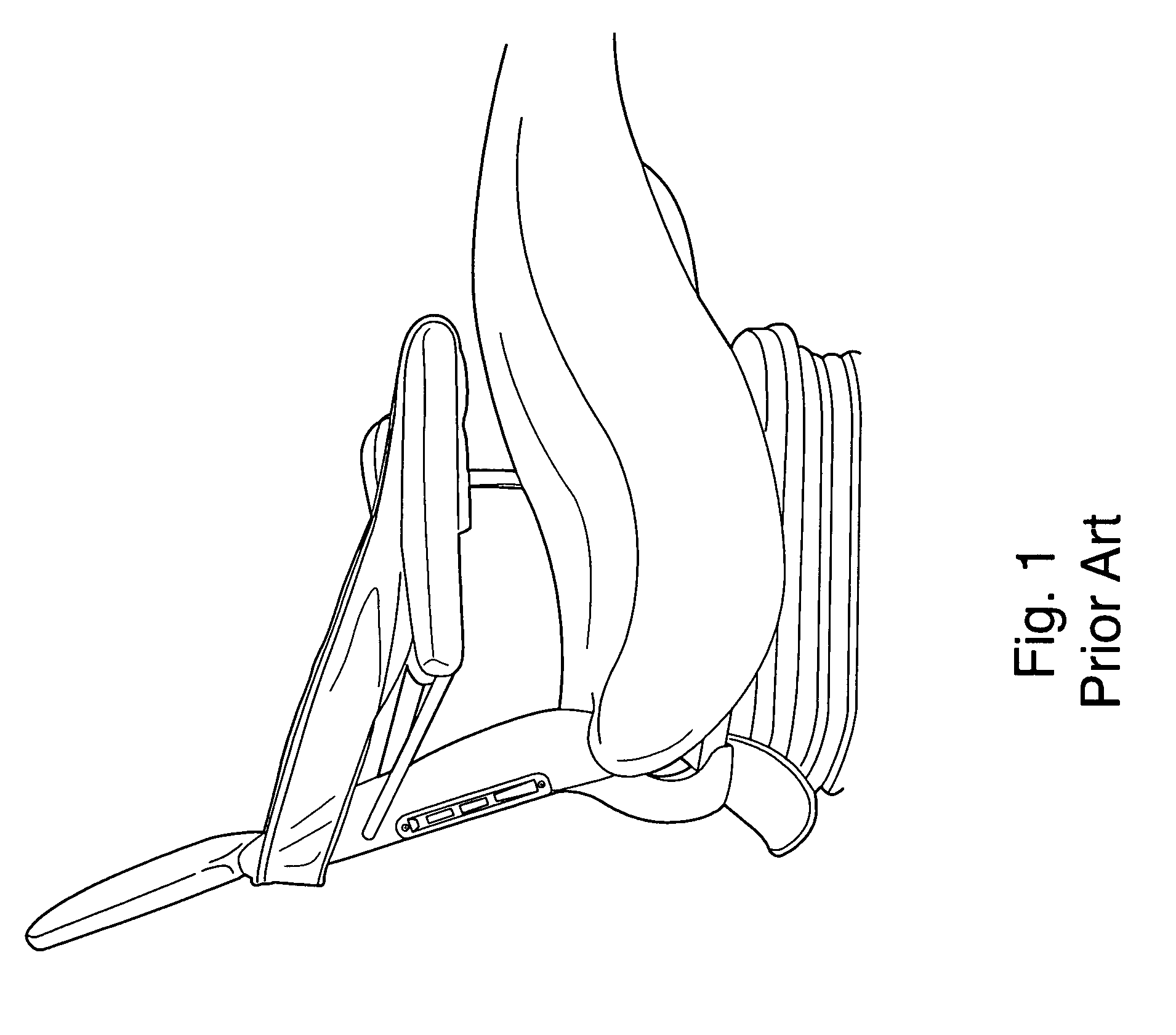 Chair arm rest system