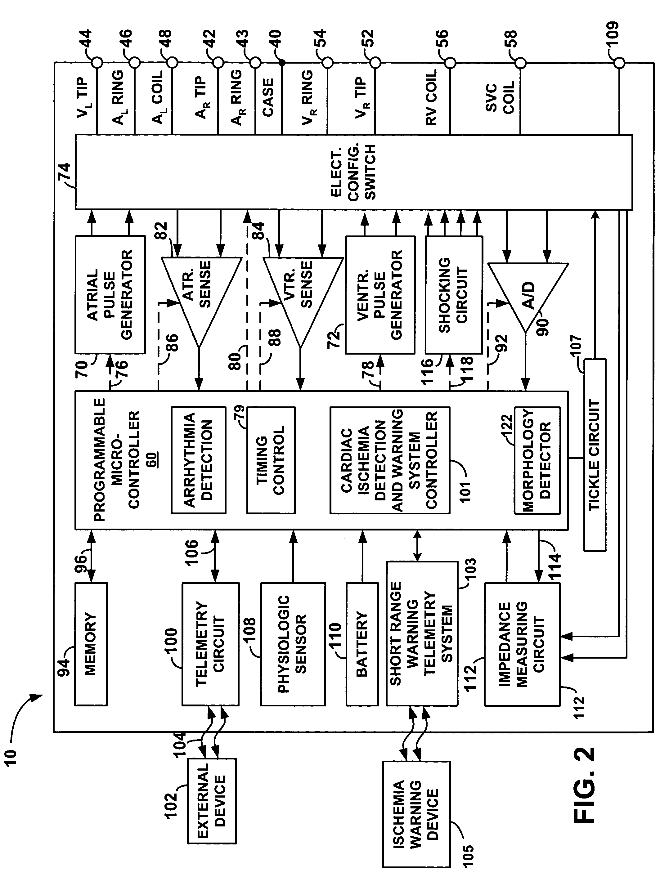 System and method for detecting cardiac ischemia using an implantable medical device