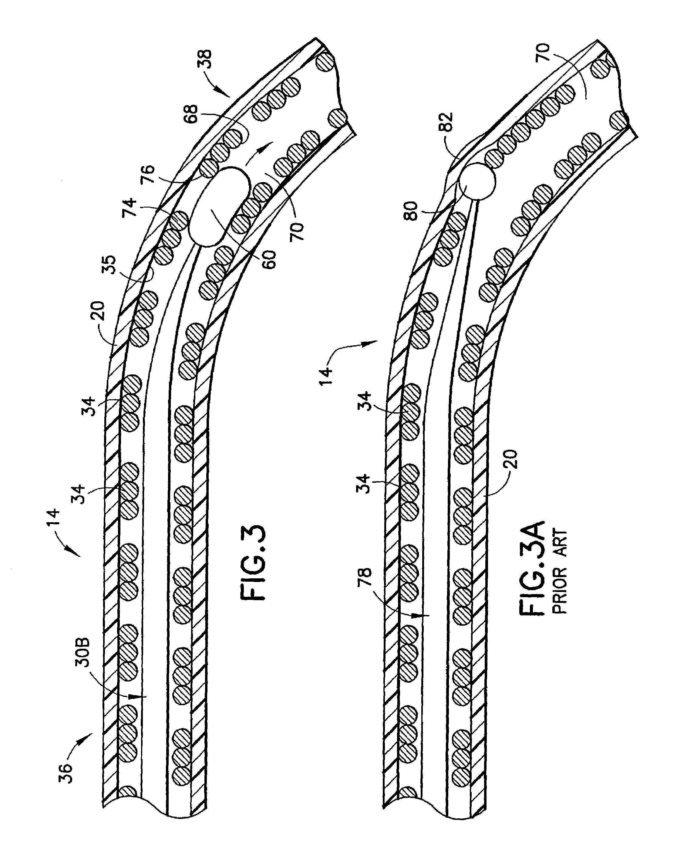 Stylet feature for resisting perforation of an implantable lead