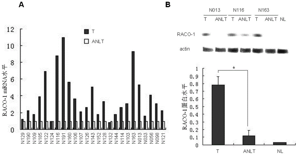 Drugs for treating liver cancer and application of raco-1 monoclonal antibody