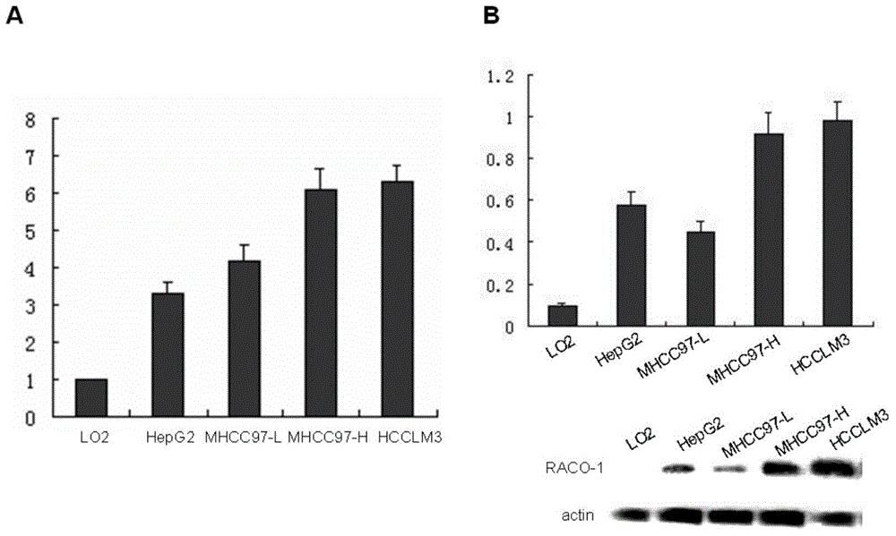 Drugs for treating liver cancer and application of raco-1 monoclonal antibody