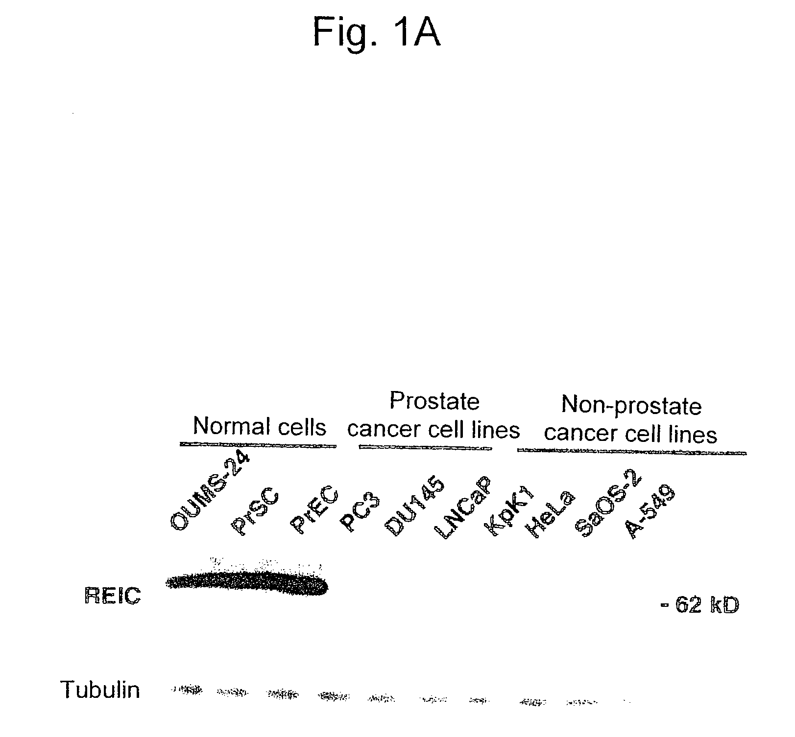 Apoptosis-inducing agent for prostate cancer cells