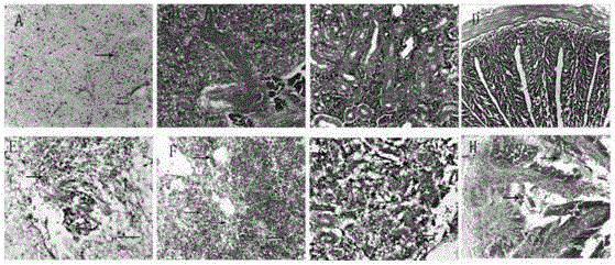 Aeromonas hydrophila and aeromonas veronii duplex oral sustained-release microsphere vaccine and preparation method thereof