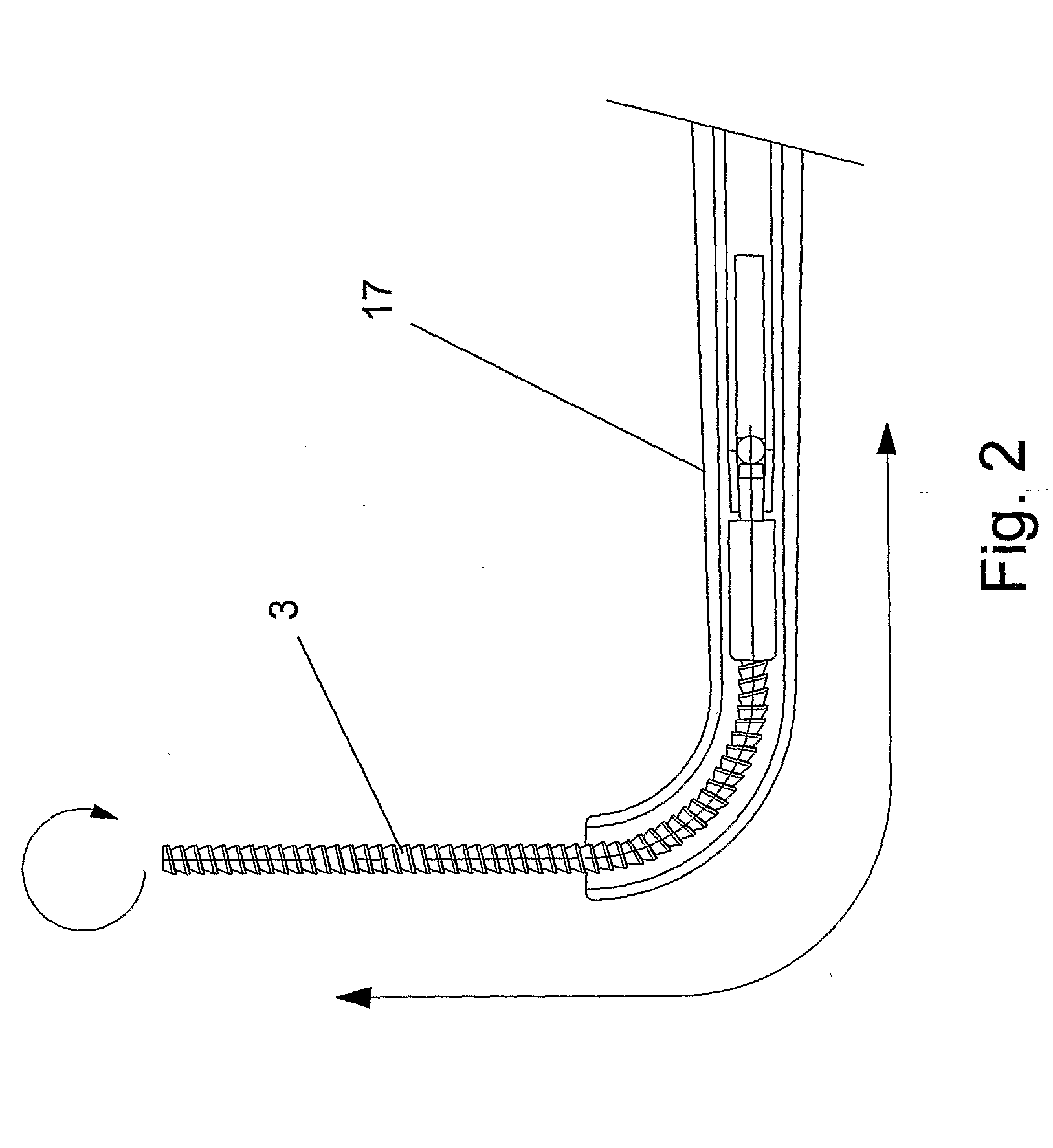 Teeth Cleaning Apparatus