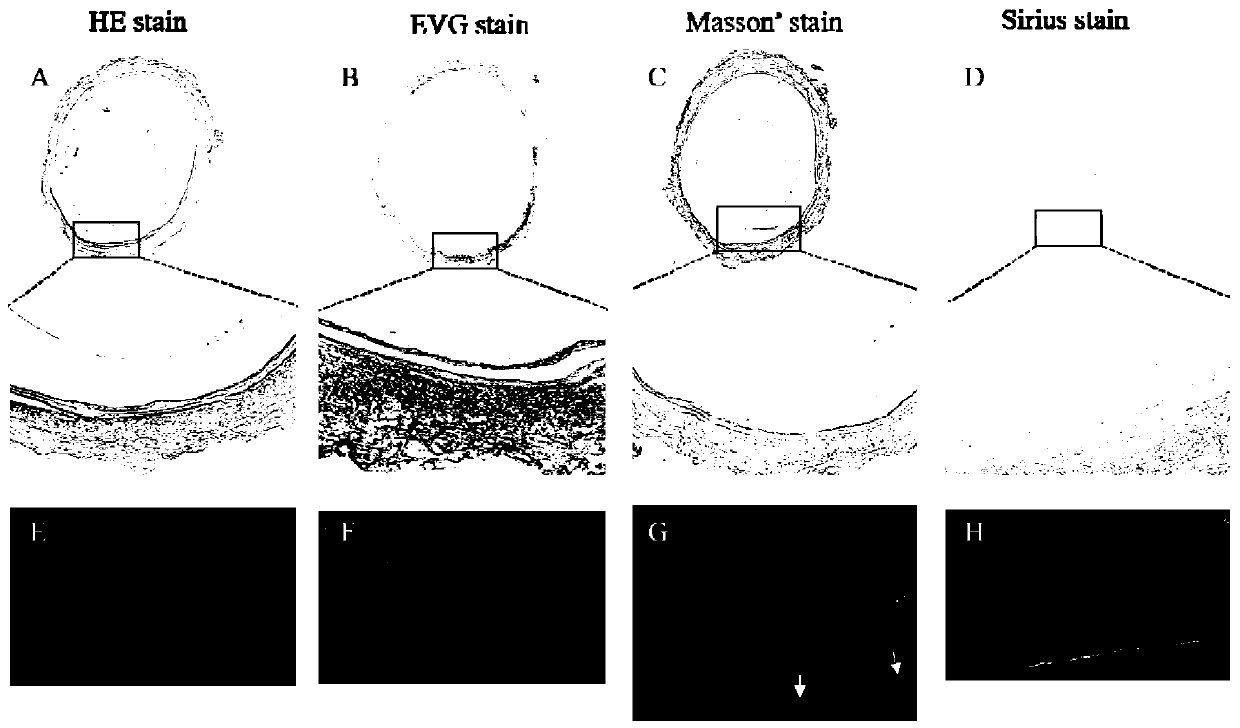 Tissue-engineered urethral stent graft, and preparation method and application thereof