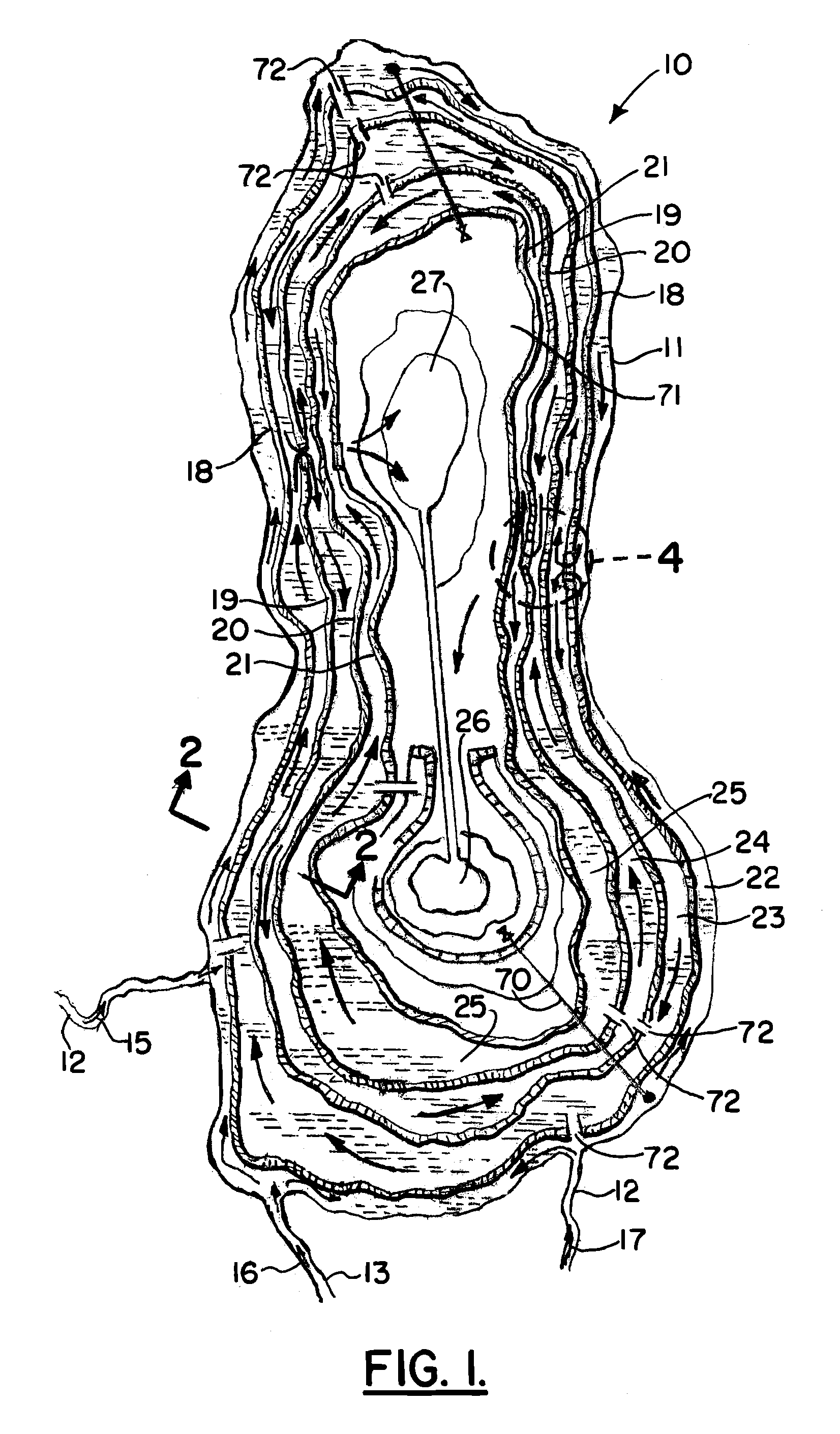 Method of restoration of a highly saline lake