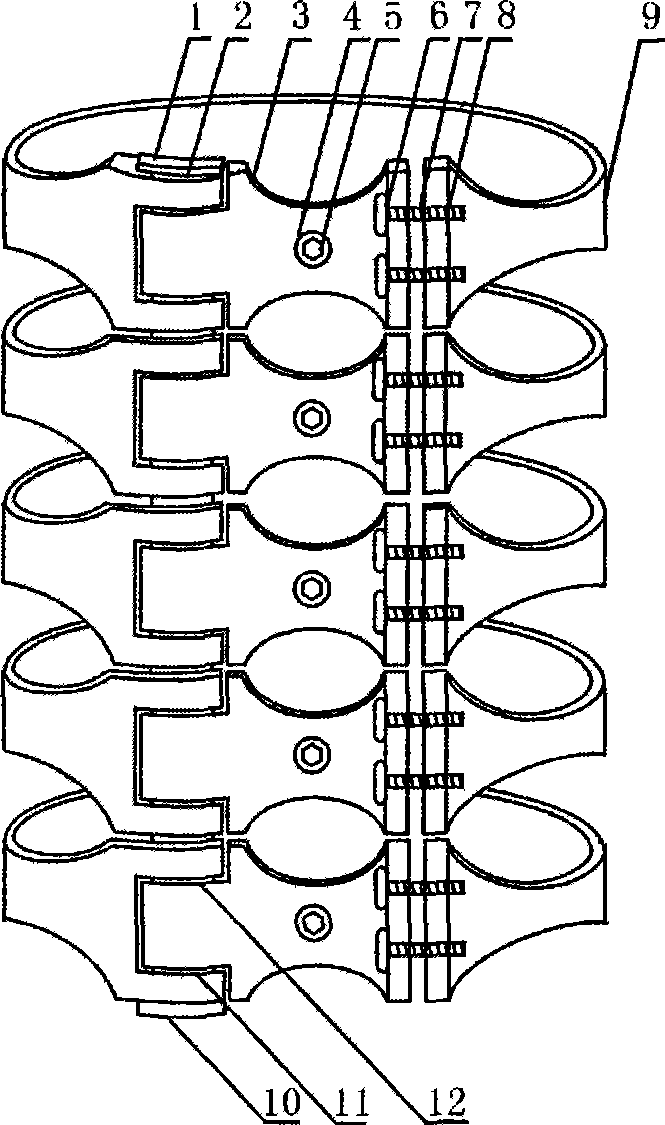 Medical hinge type ring-shaped pressure steel plate with lock for department of orthopaedics