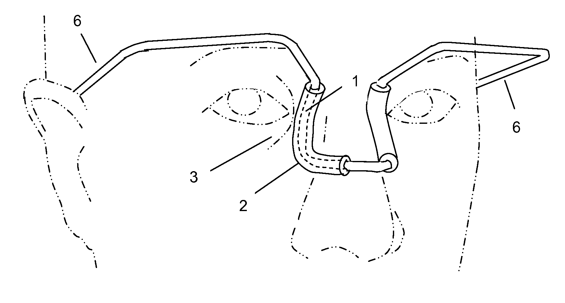 Noninvasive lacrimal canalicular occlusion device and method