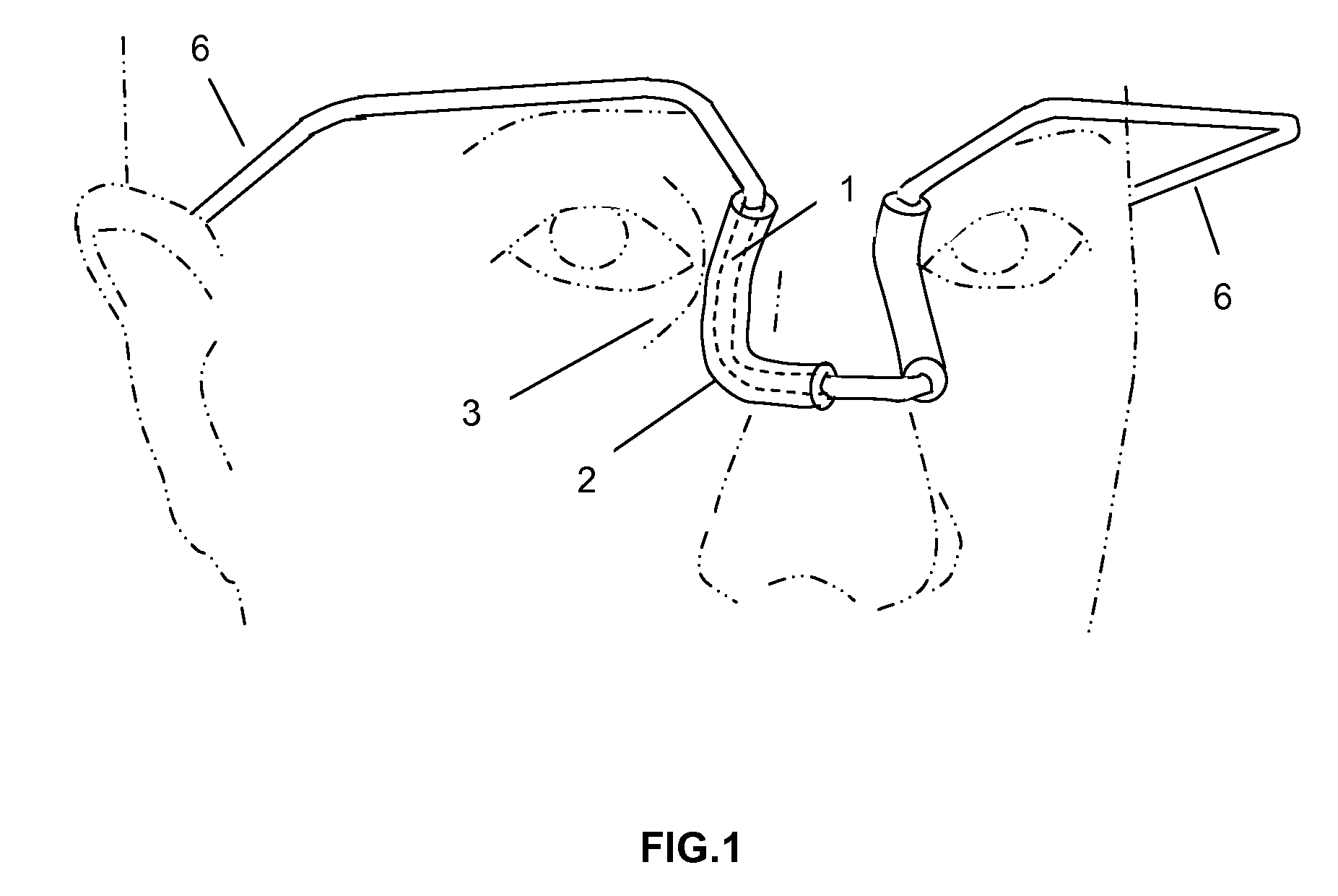 Noninvasive lacrimal canalicular occlusion device and method