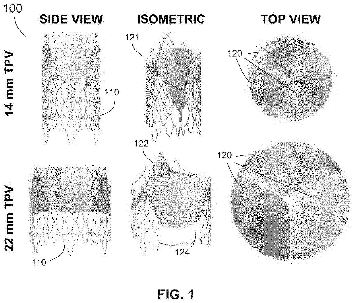 Growth-accommodating valve system