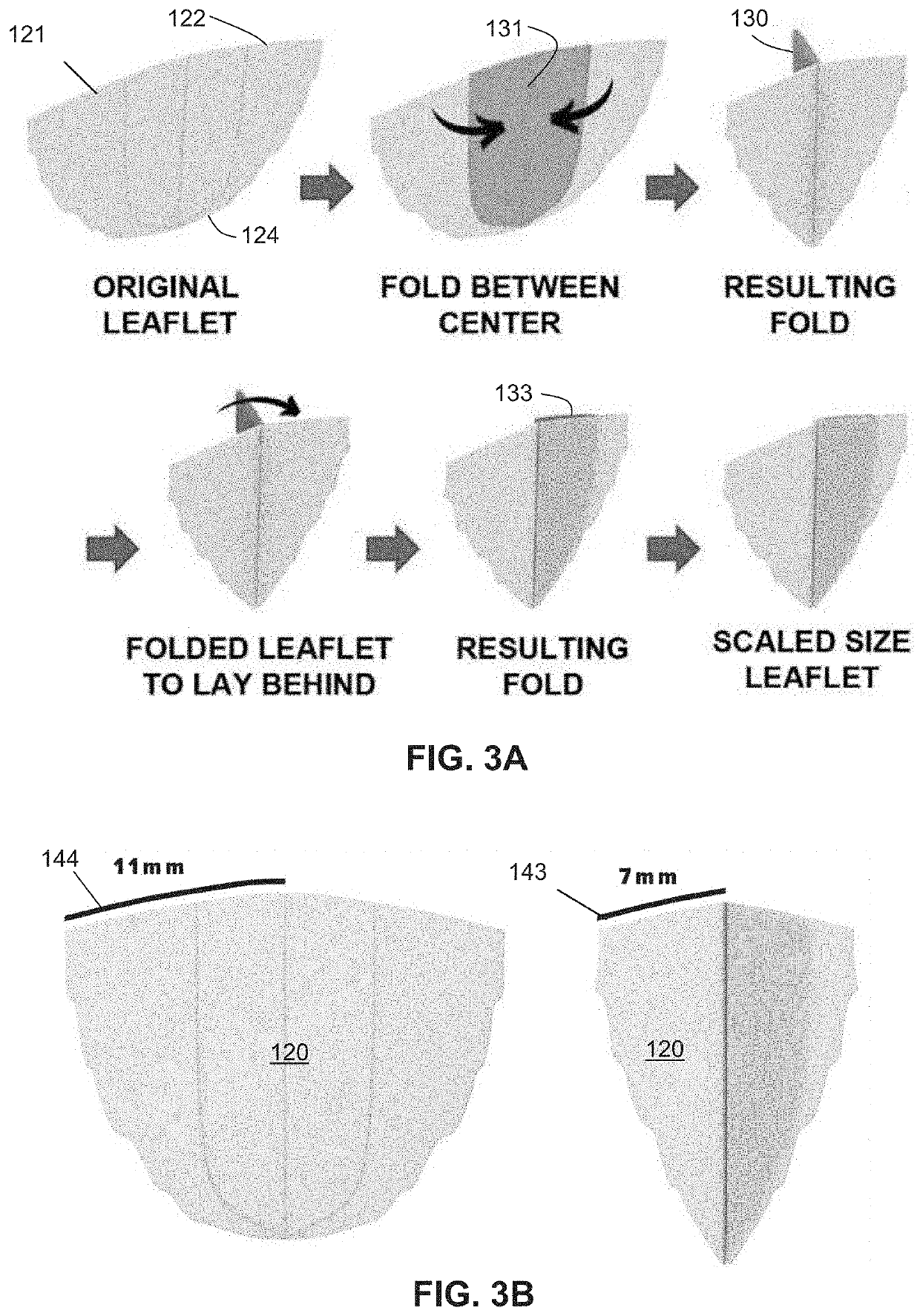 Growth-accommodating valve system