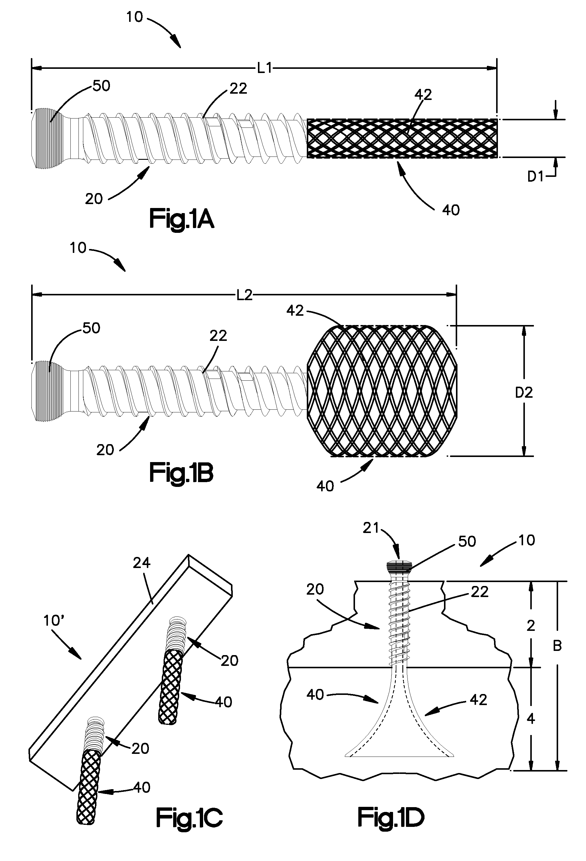 Hybrid bone fixation element and methods of using the same