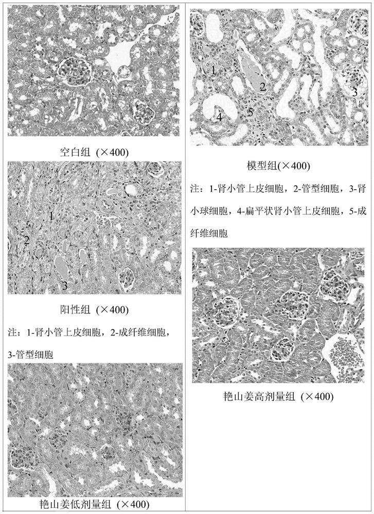 Application of alpinia zerumbet volatile oil in preparation of medicine for treating hyperuricemia