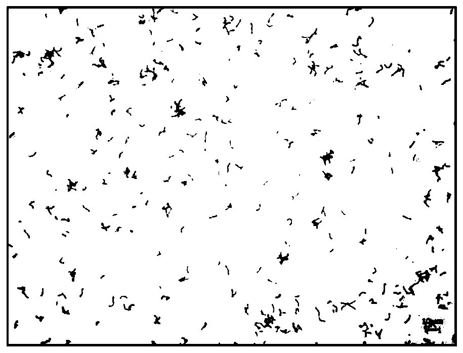 Bifidobacterium pseudocatenatum and application thereof