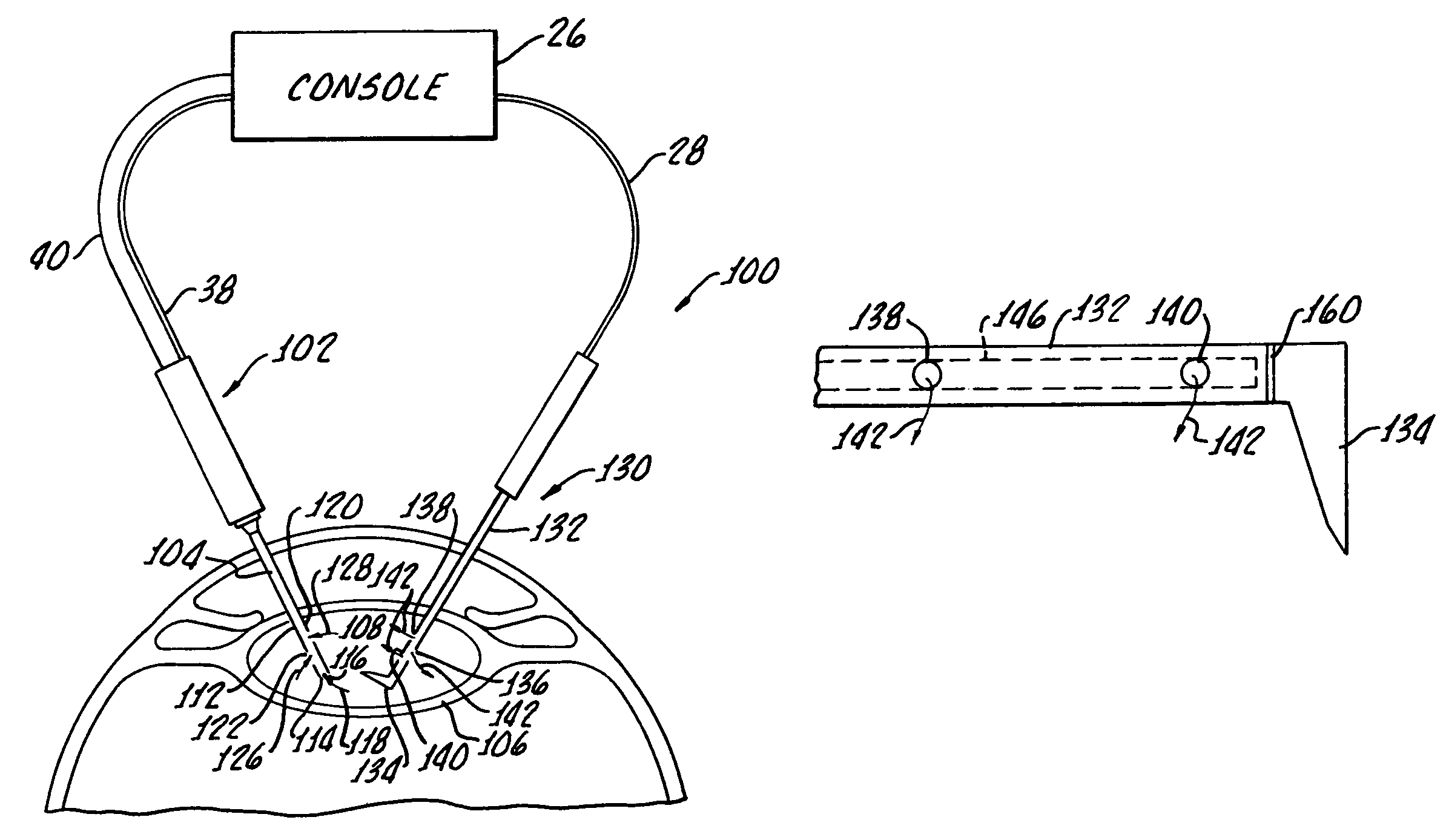 Multi-functional second instrument for cataract removal