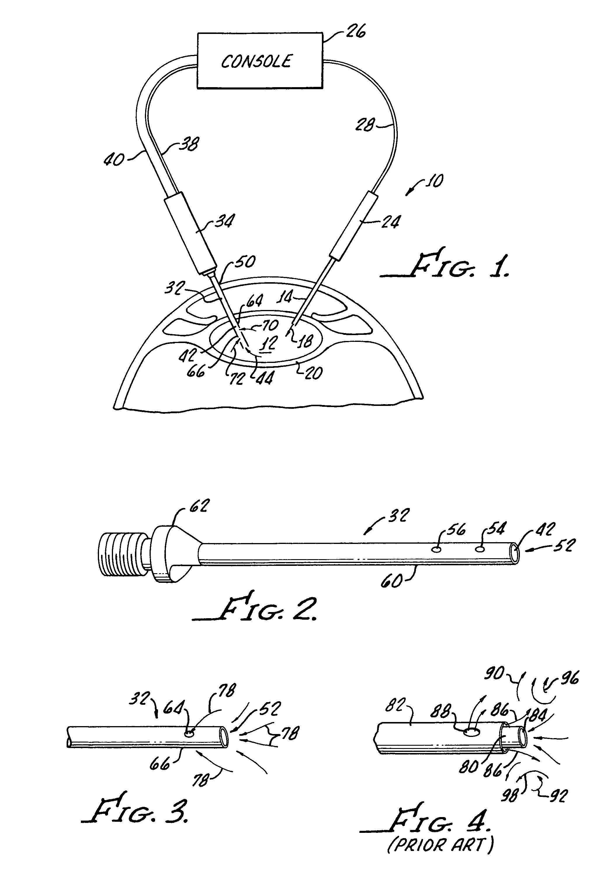 Multi-functional second instrument for cataract removal