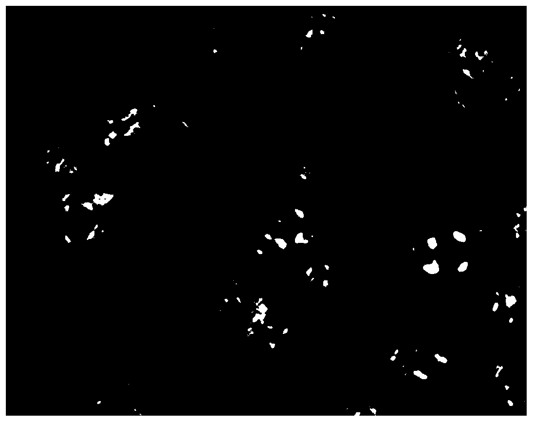 Drug-loaded polyvinyl alcohol microsphere