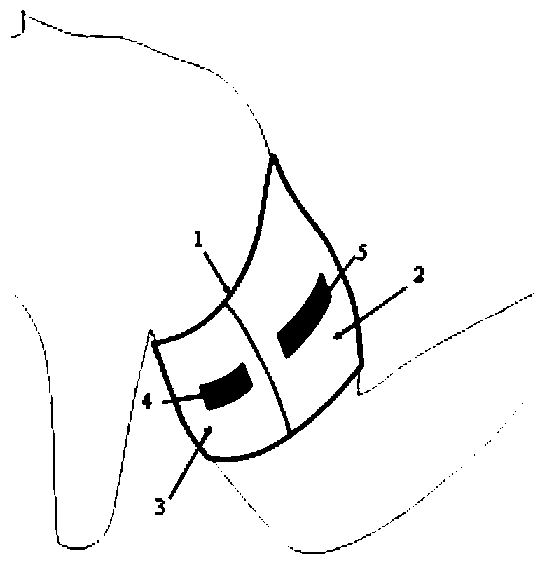 Wearable intelligent armband for muscle exercise monitoring and muscle movement state monitoring method