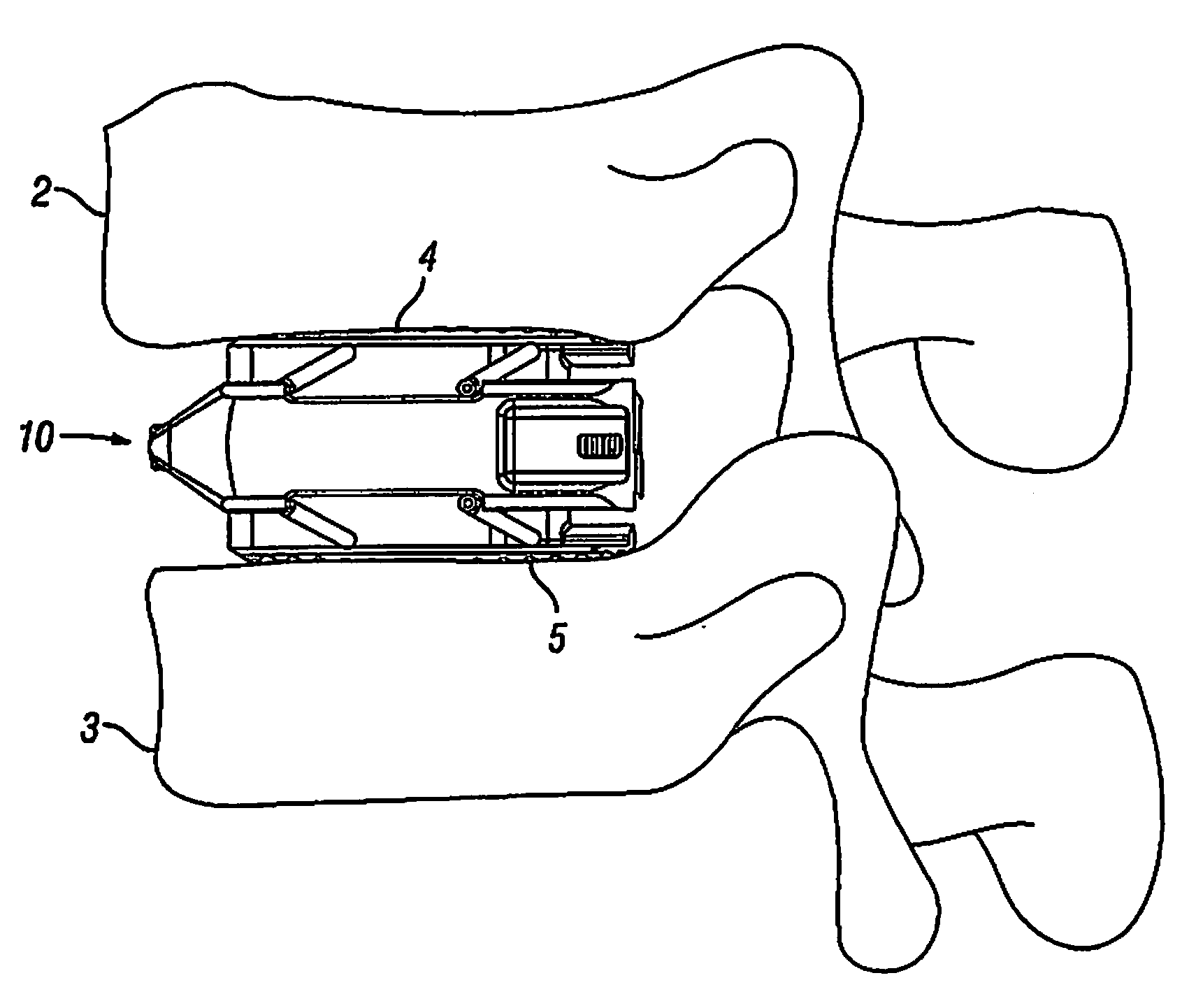 Expandable Fusion Device and Method of Installation Thereof