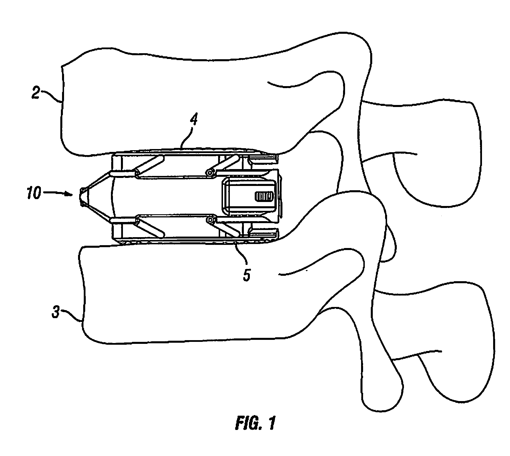 Expandable Fusion Device and Method of Installation Thereof