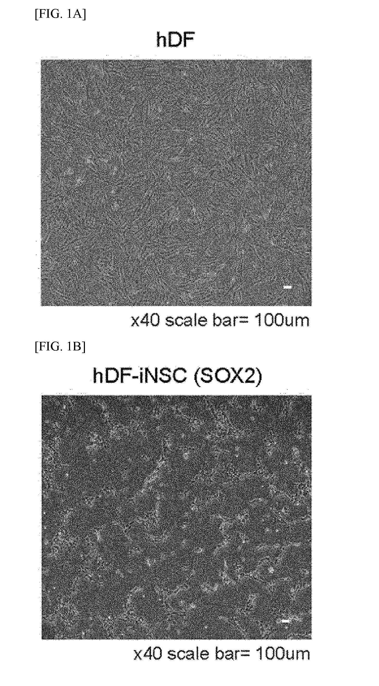 Method of Preparing Induced Neural Stem Cells Reprogrammed from Non-Neuronal Cells Using HMGA2